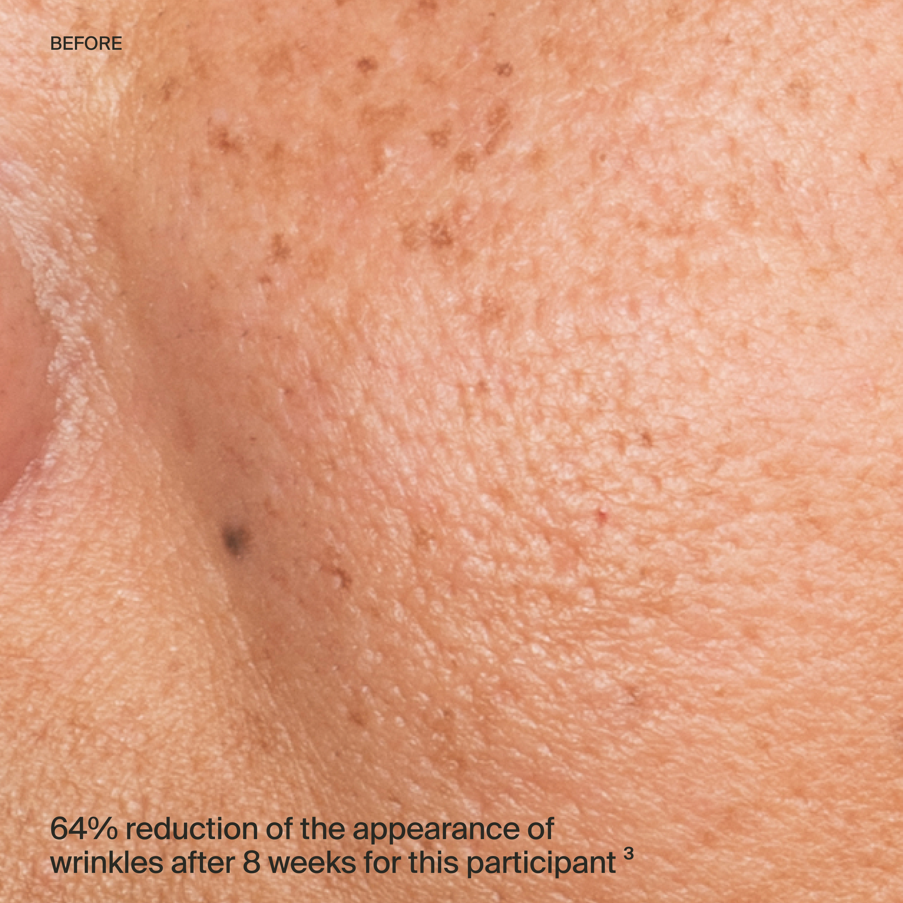 serum before-thumbnail