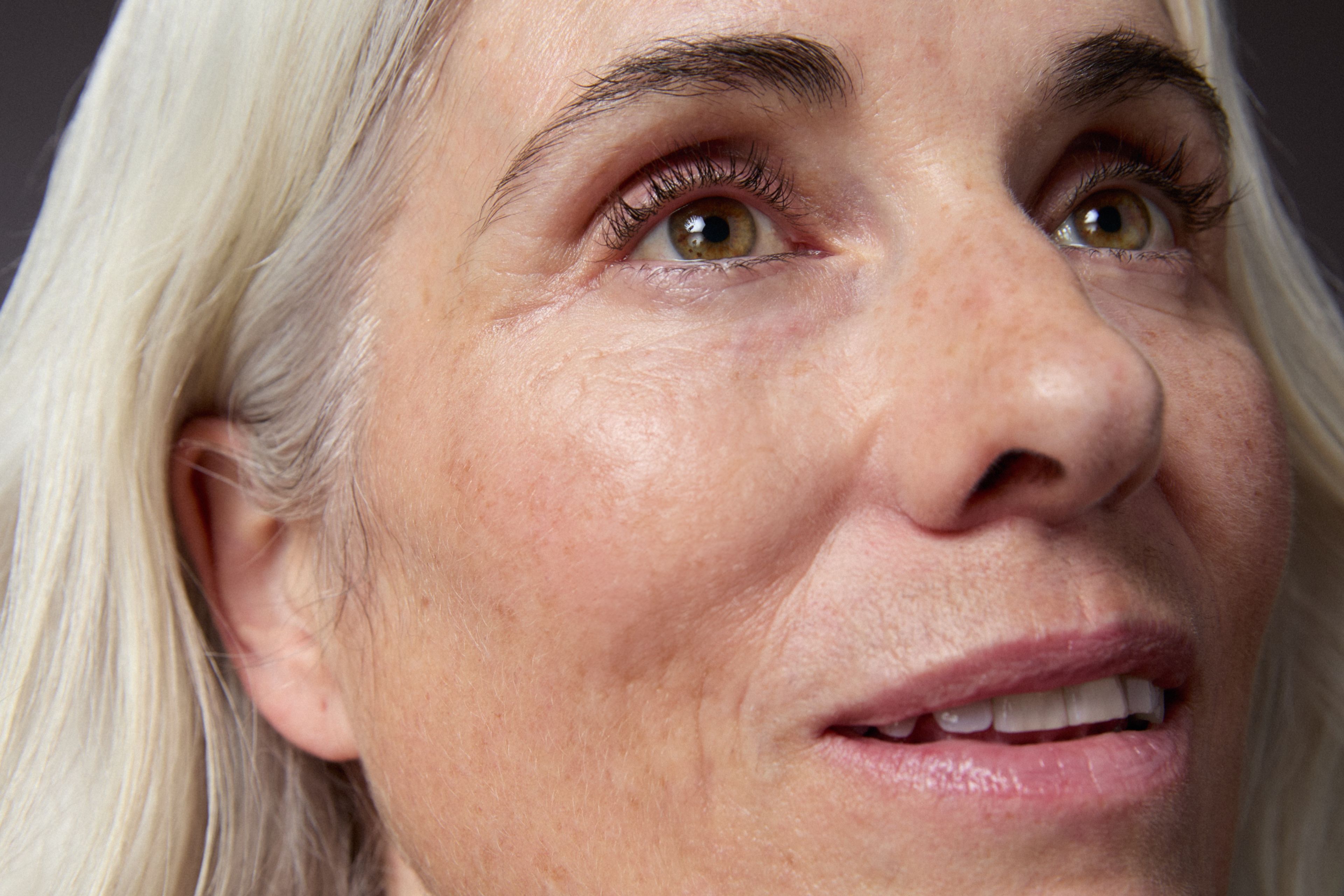 WomanSkin Aging