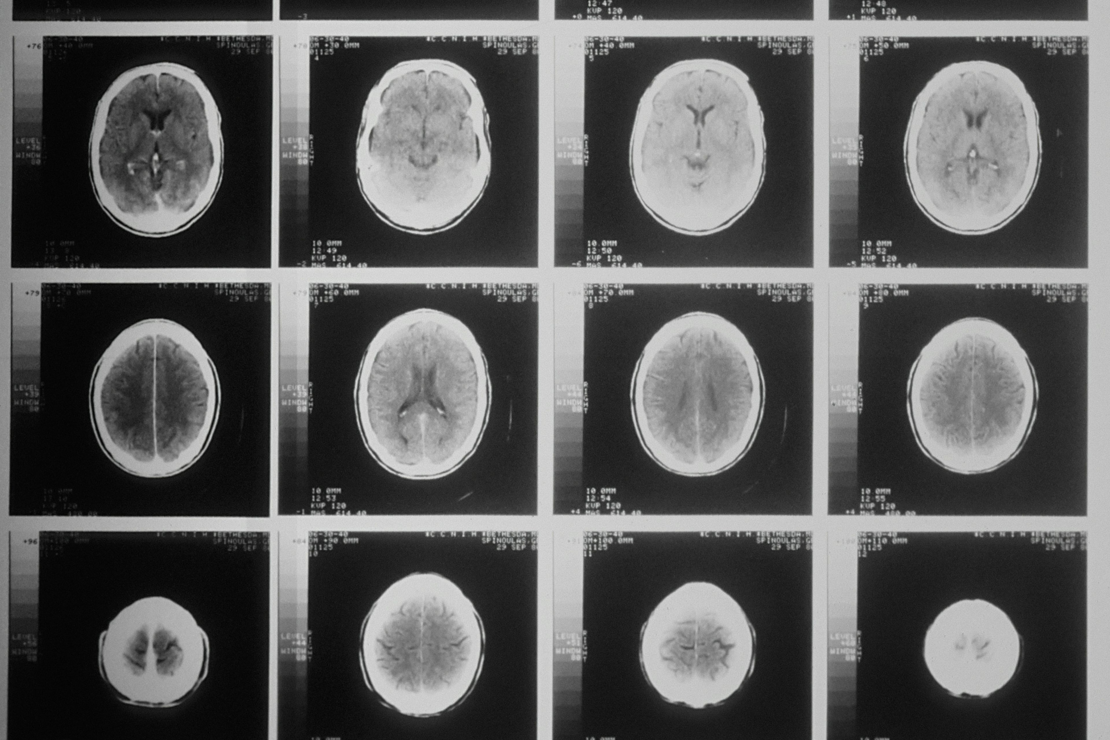 brain scans