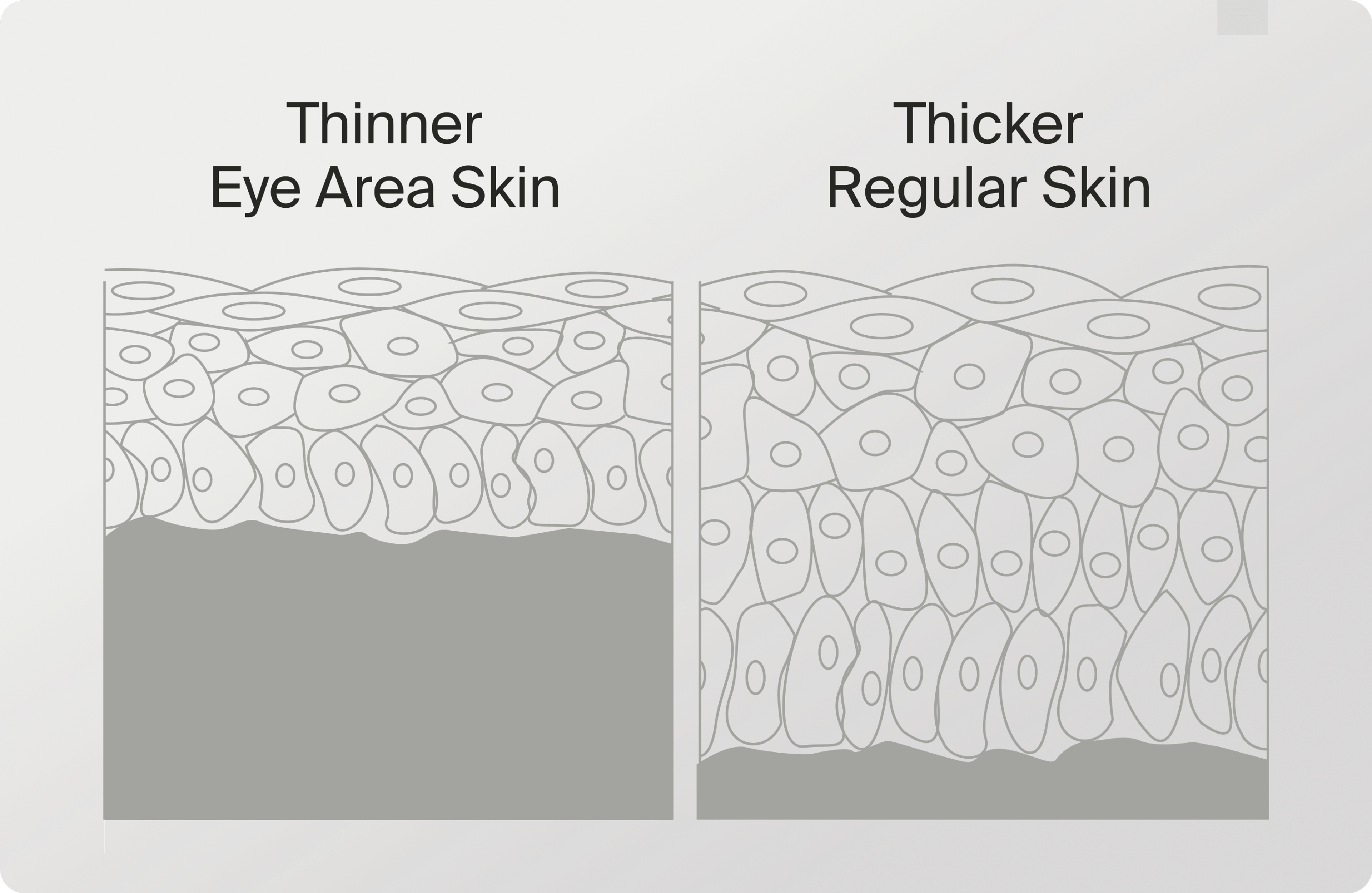 Thinner Eye Area vs Thicker Regular Skin