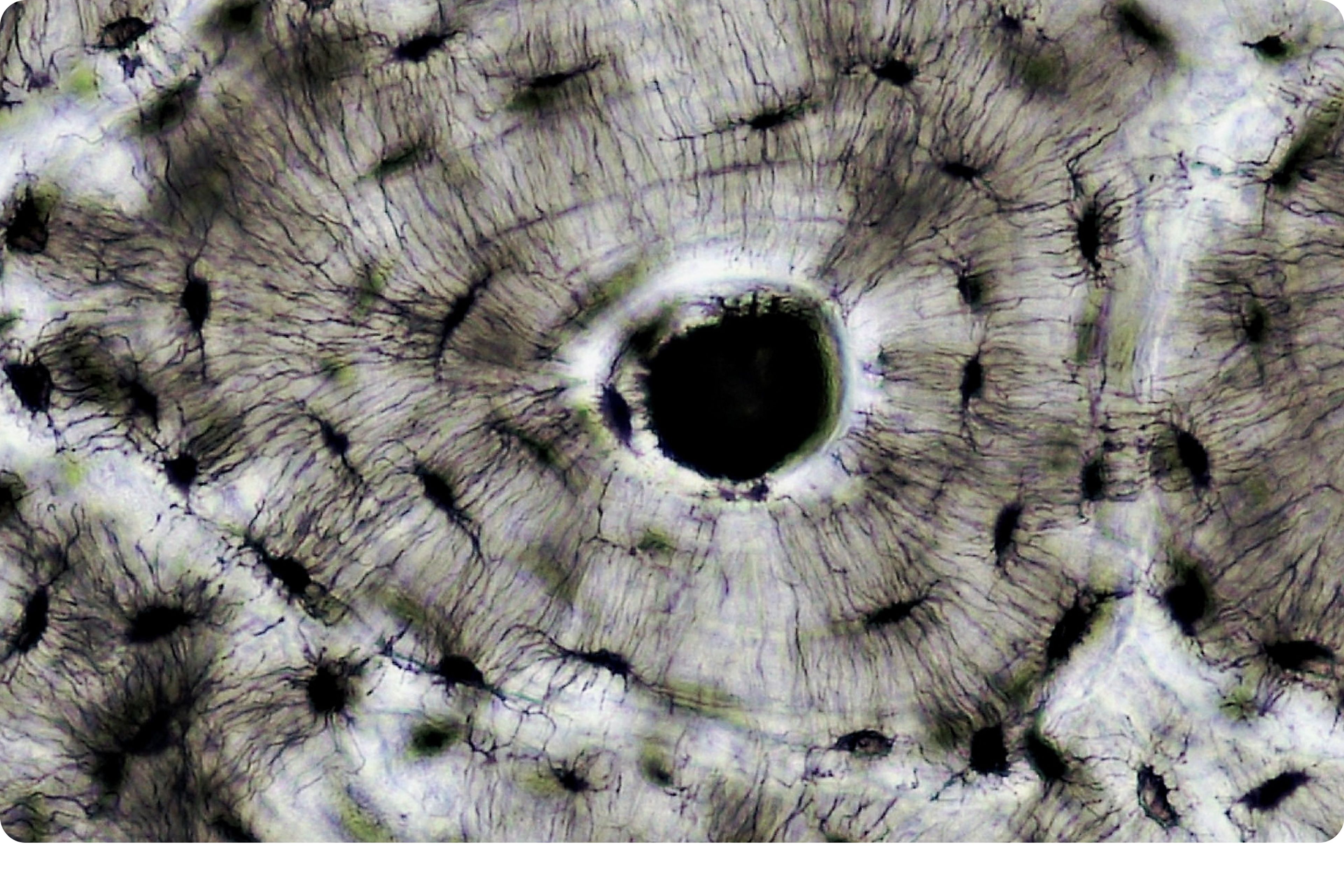 Bone tissue