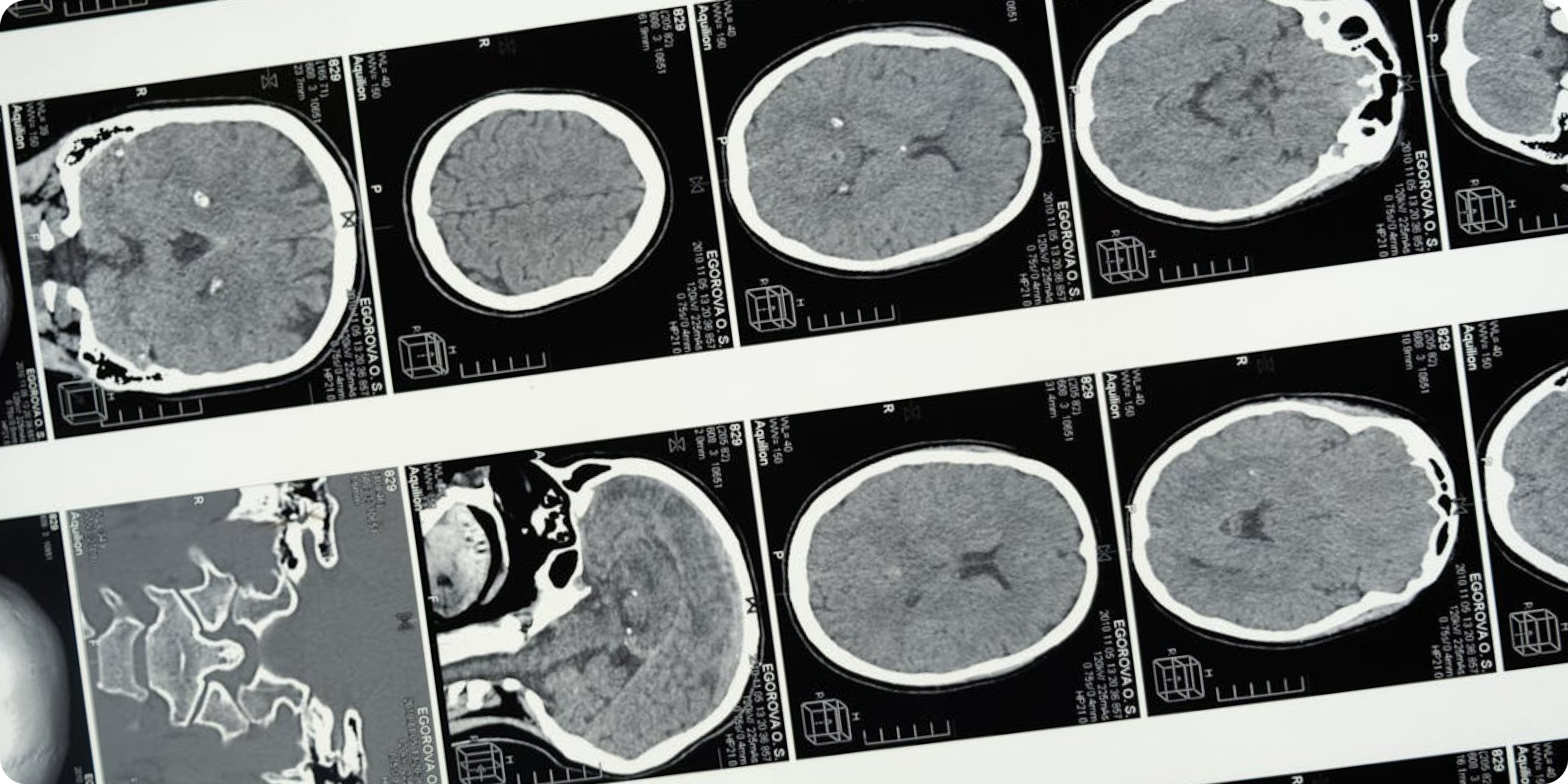 Brain scans