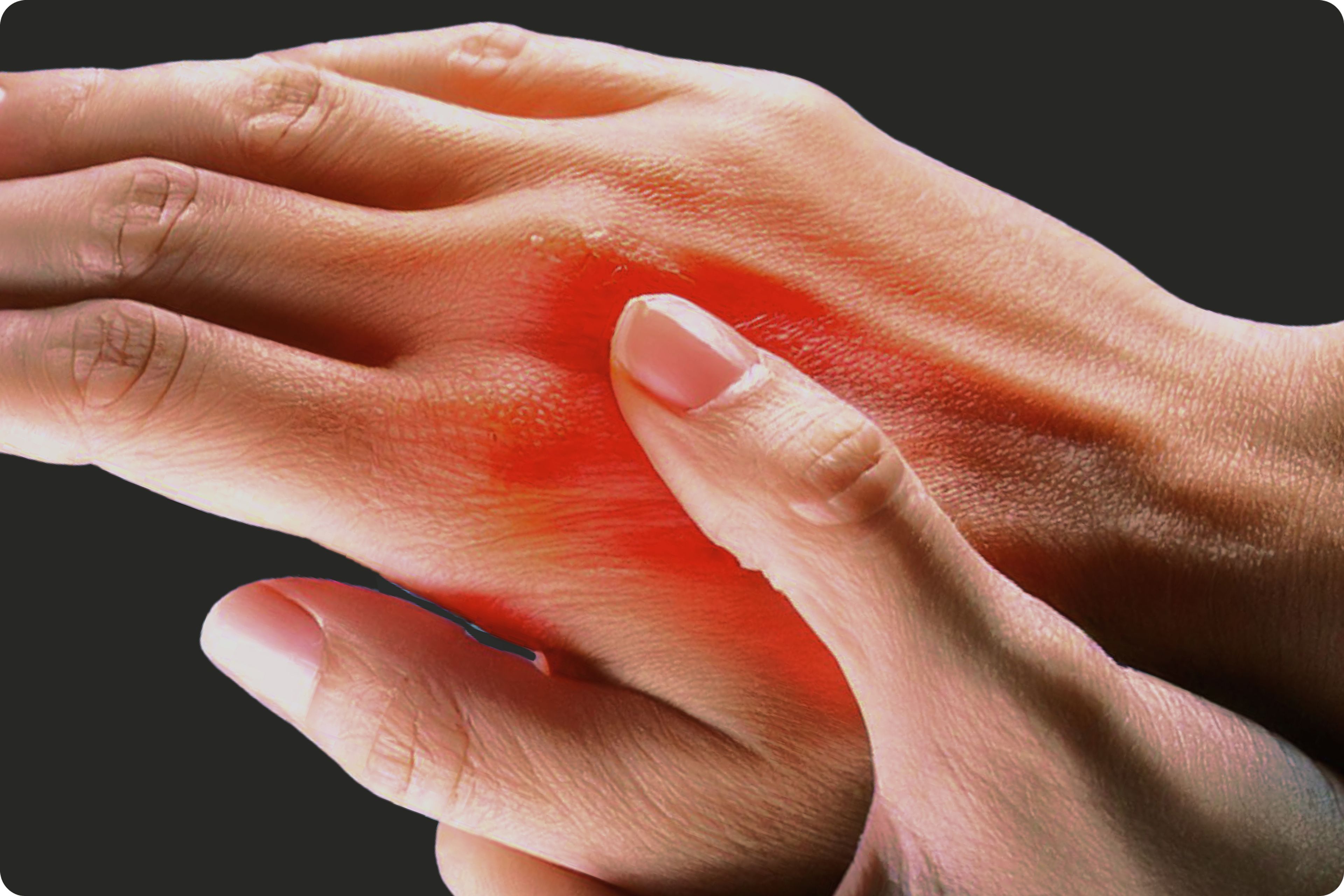 Inflammation