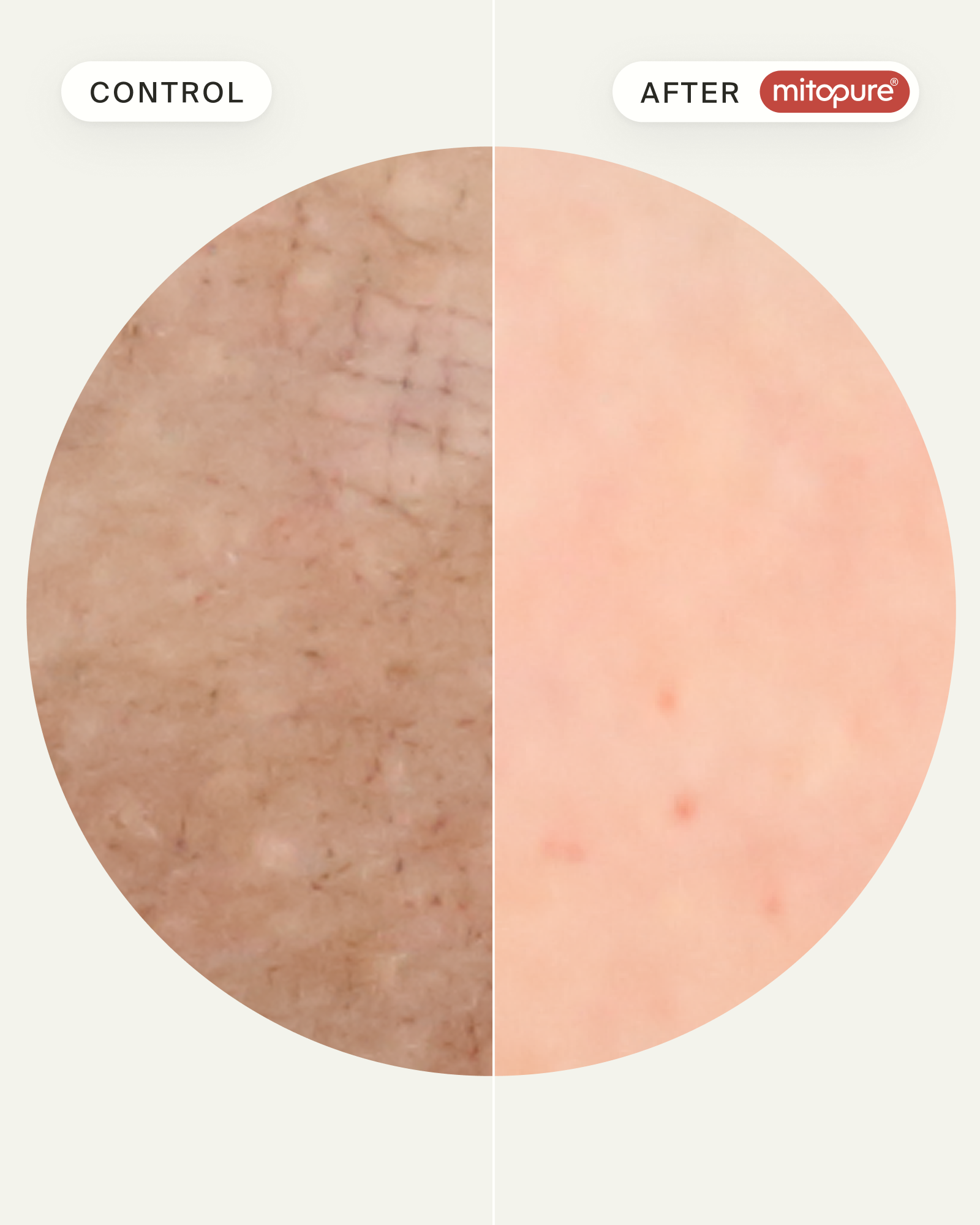 Mitopure Gentle Cleanser