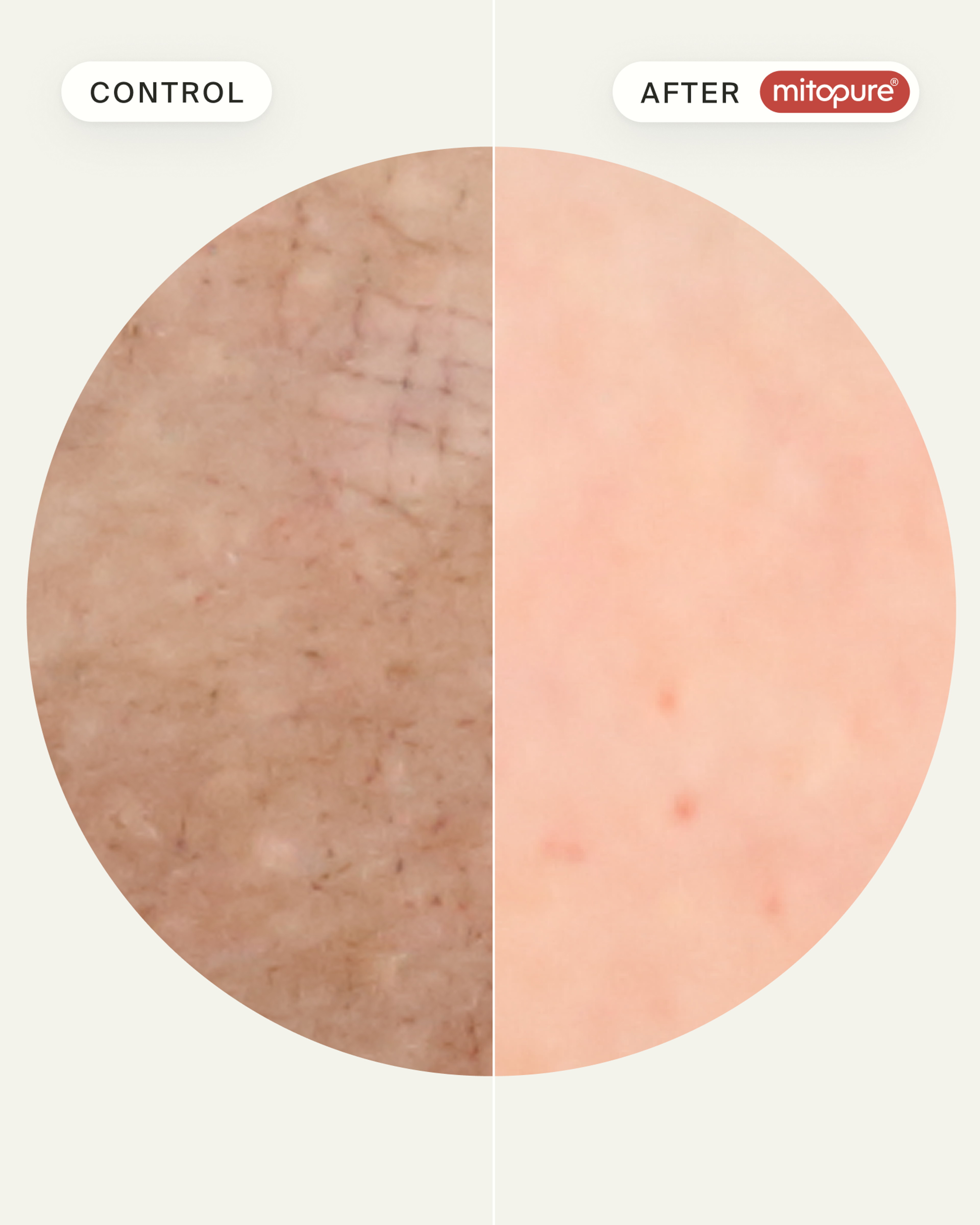 Mitopure Gentle Cleanser