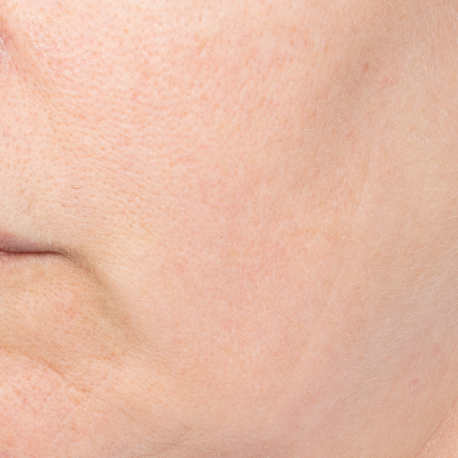 After Dewy Cream-thumbnail