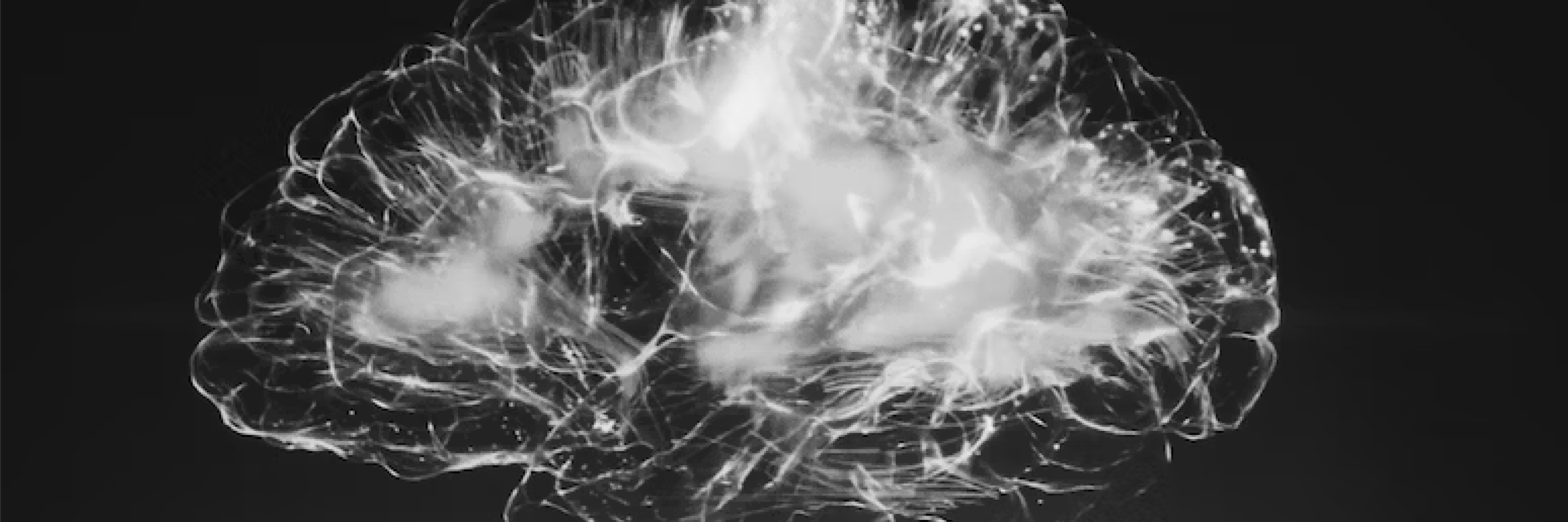 Visual of brain activity