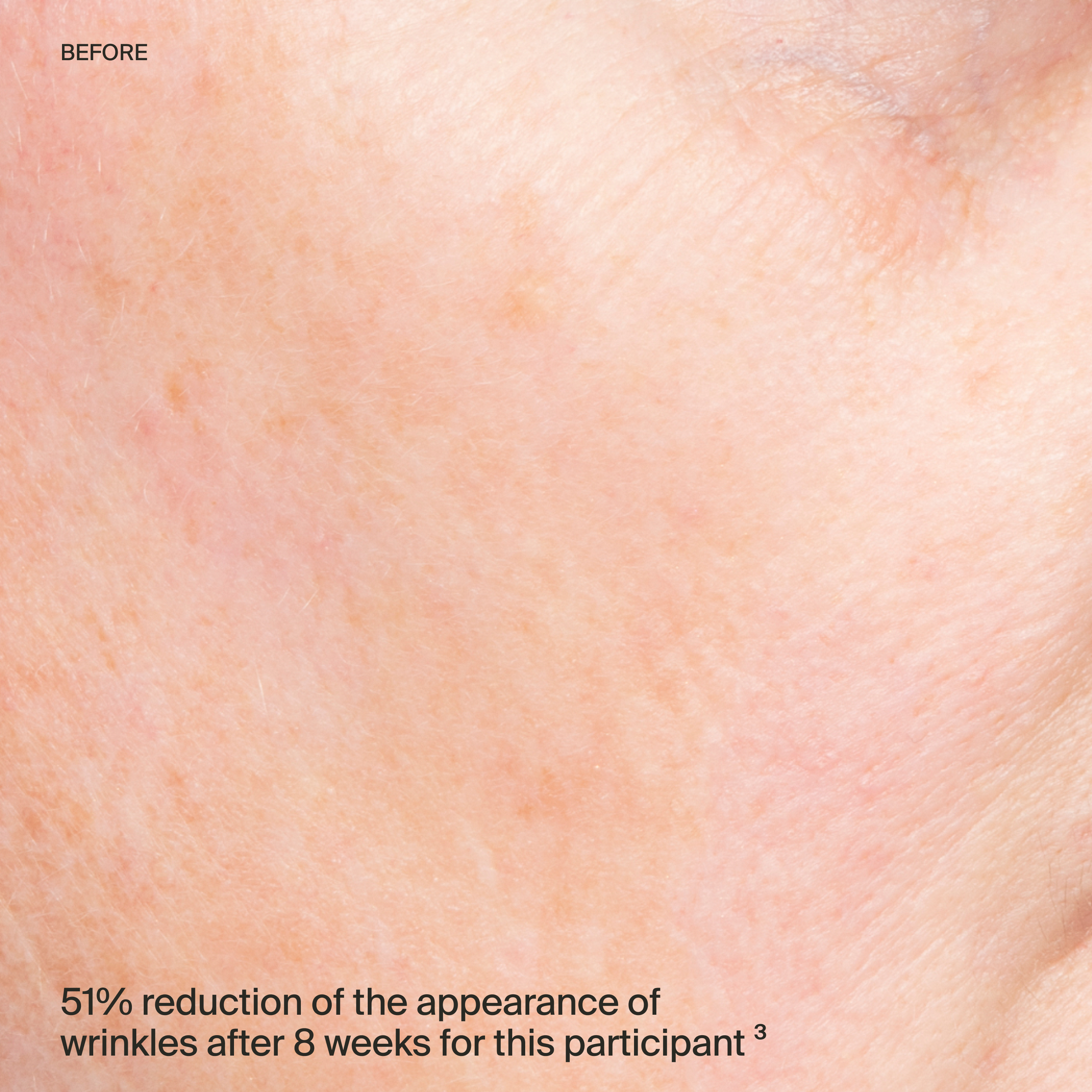  serum cheek before-thumbnail