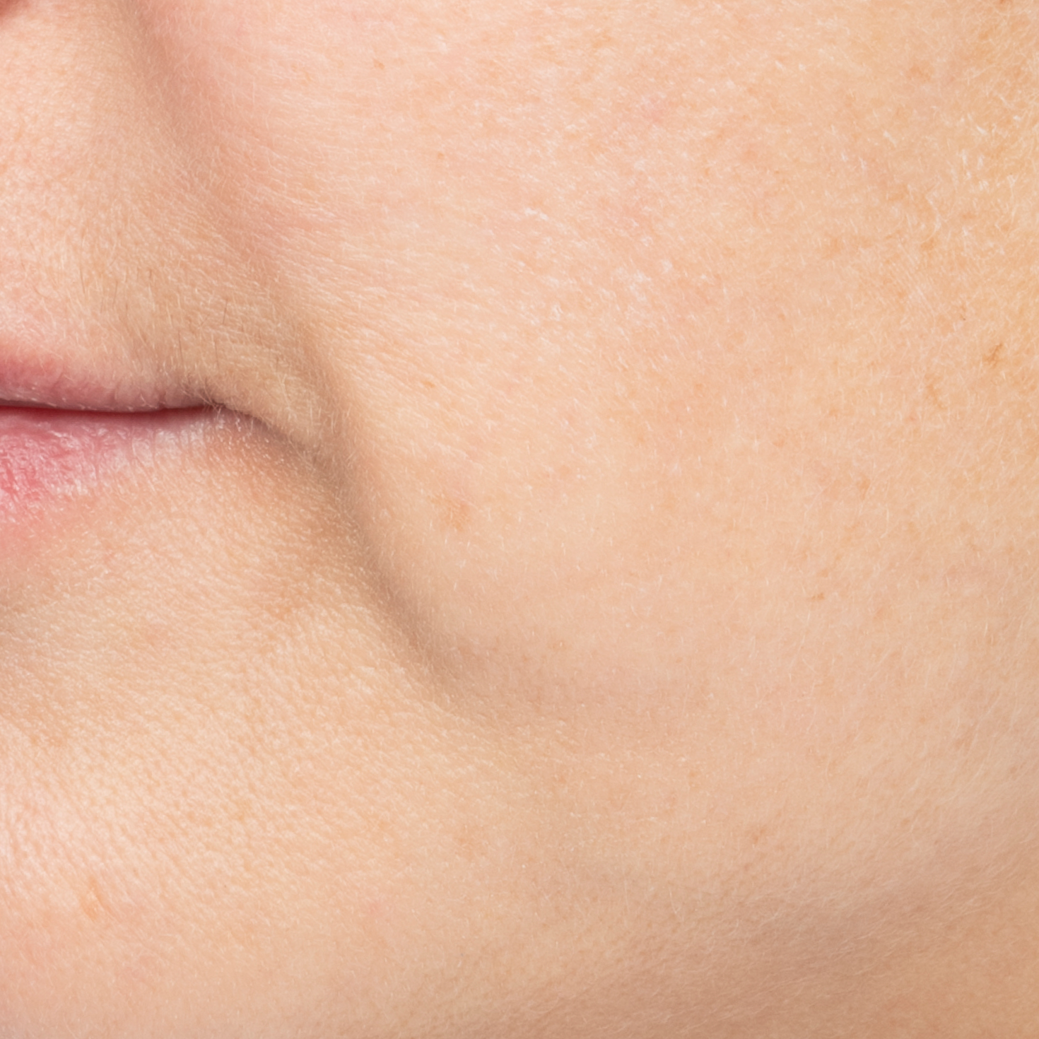 After Dewy Cream-thumbnail