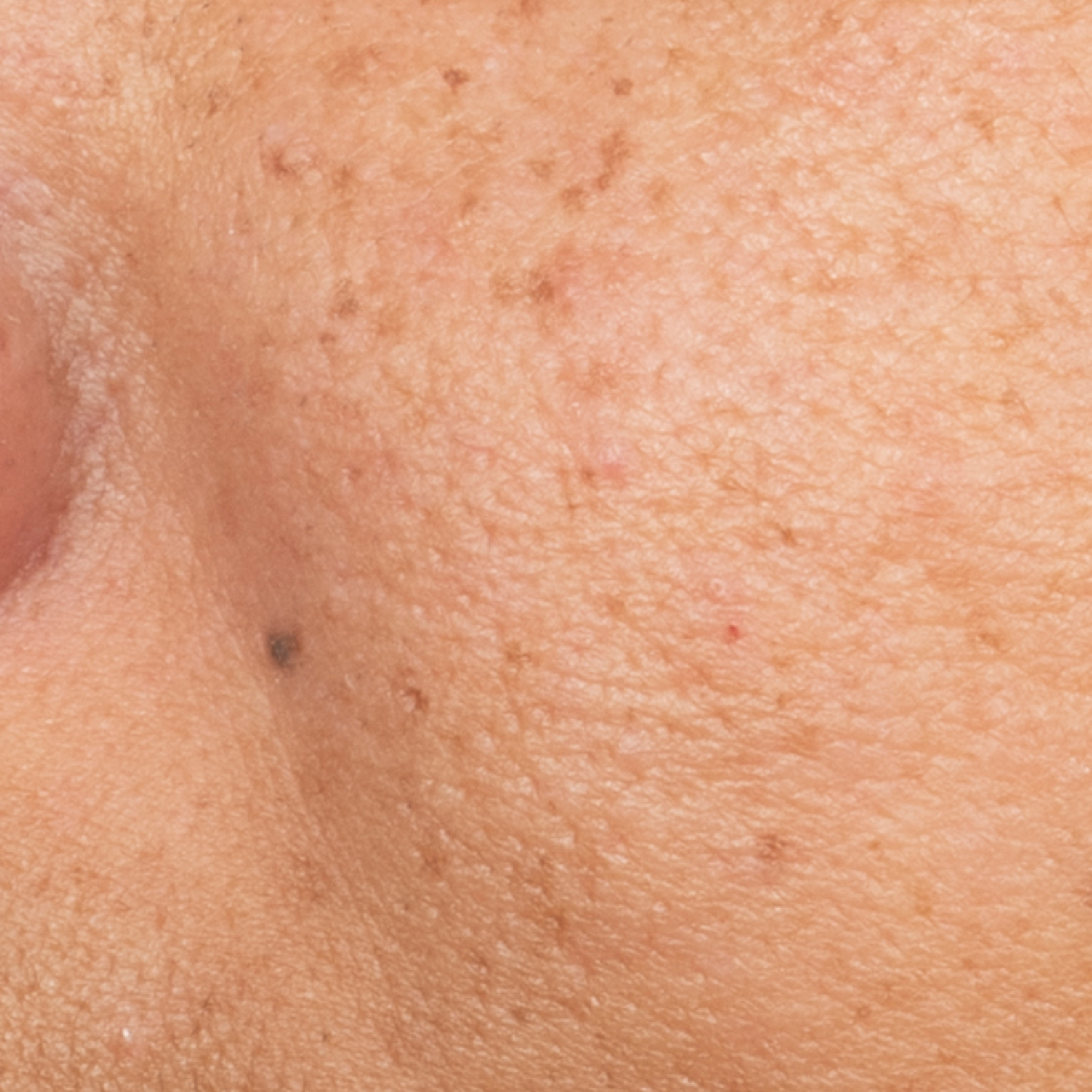 Serum After-thumbnail