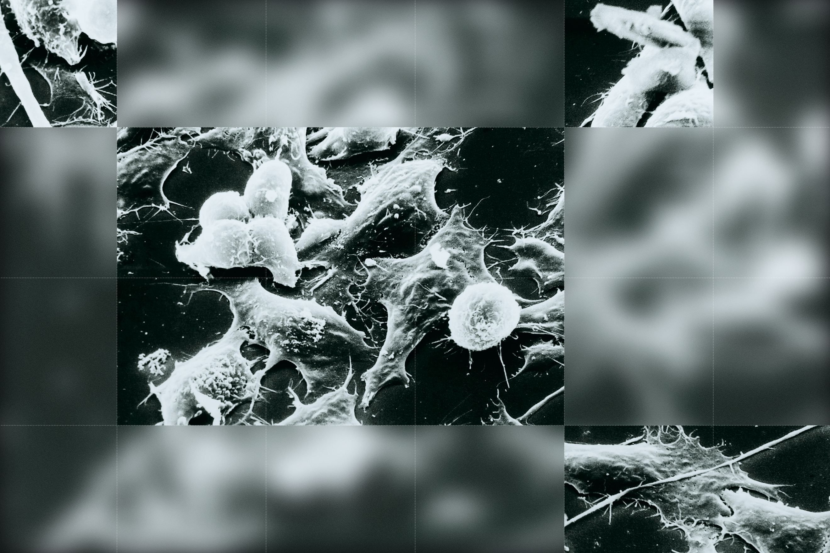 Zombie Cells