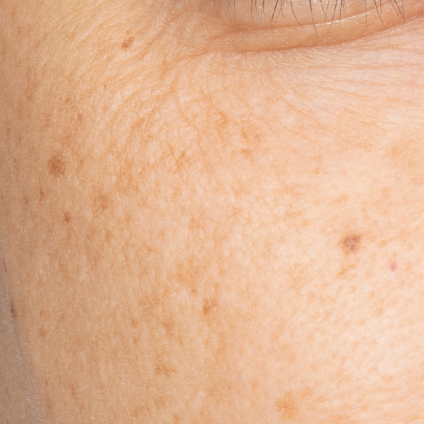 Before Barrier Cream