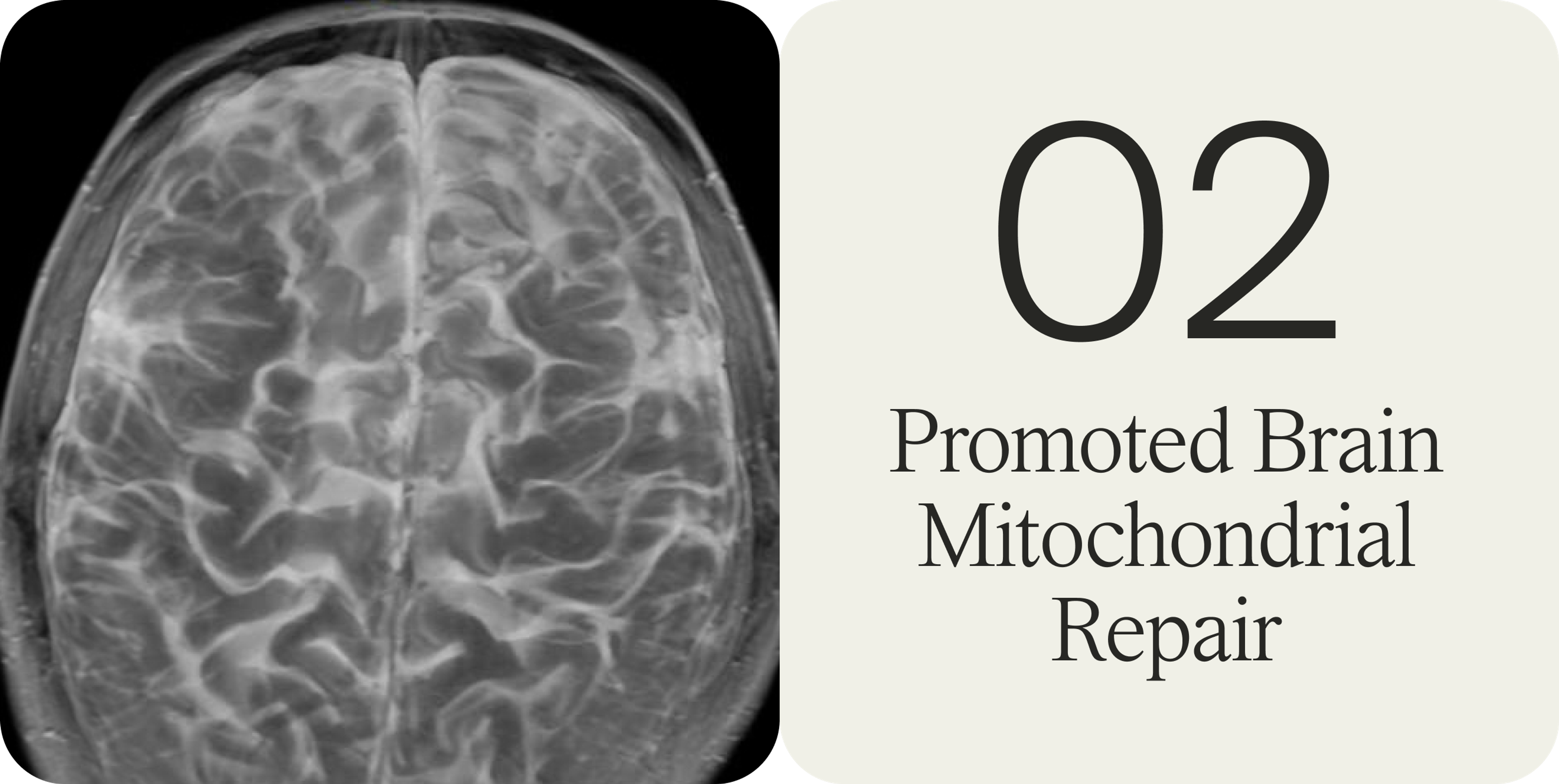 Urolithin A Promoted Brain Mitochondrial Repair