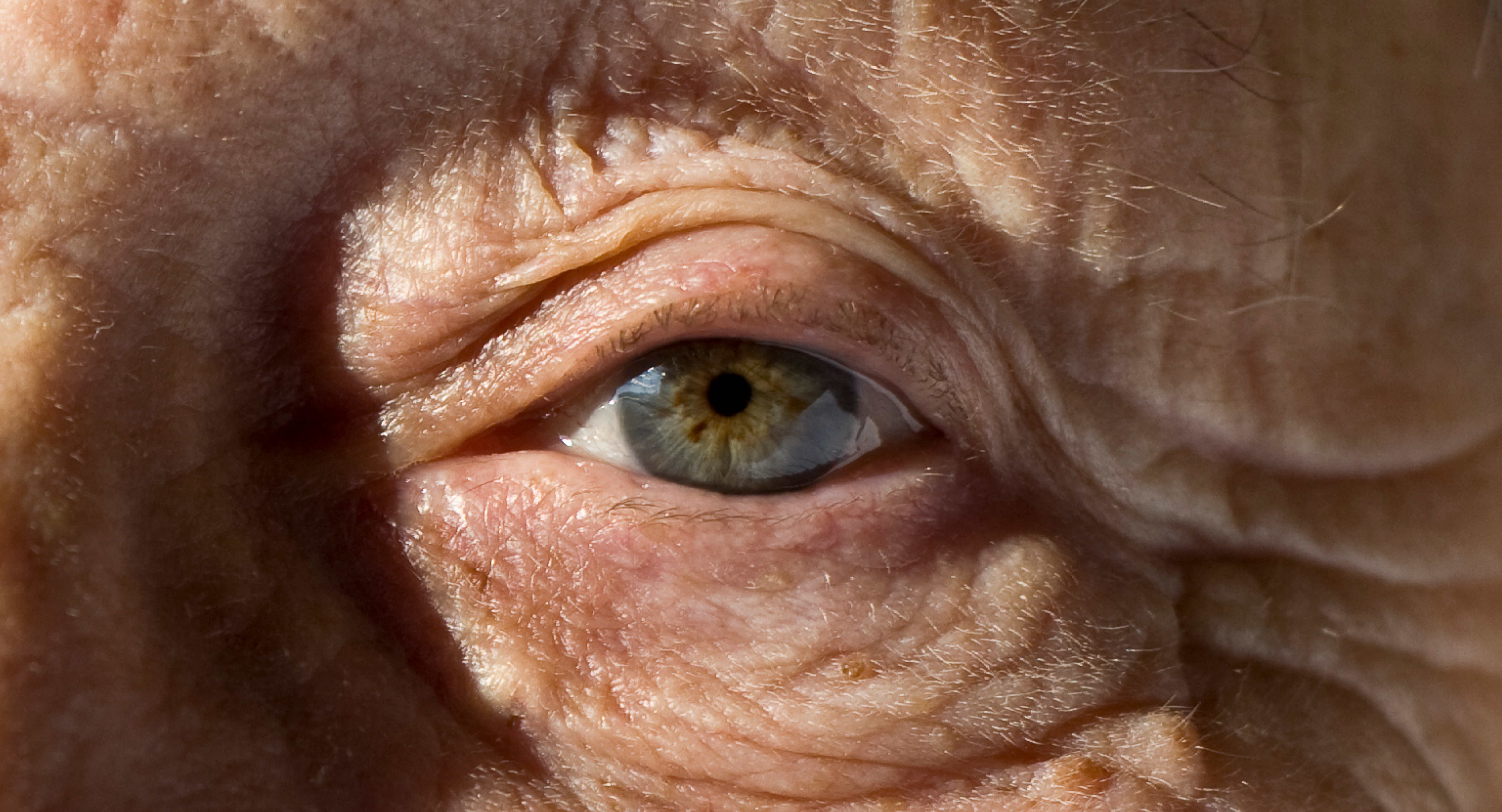 Old persons' eye