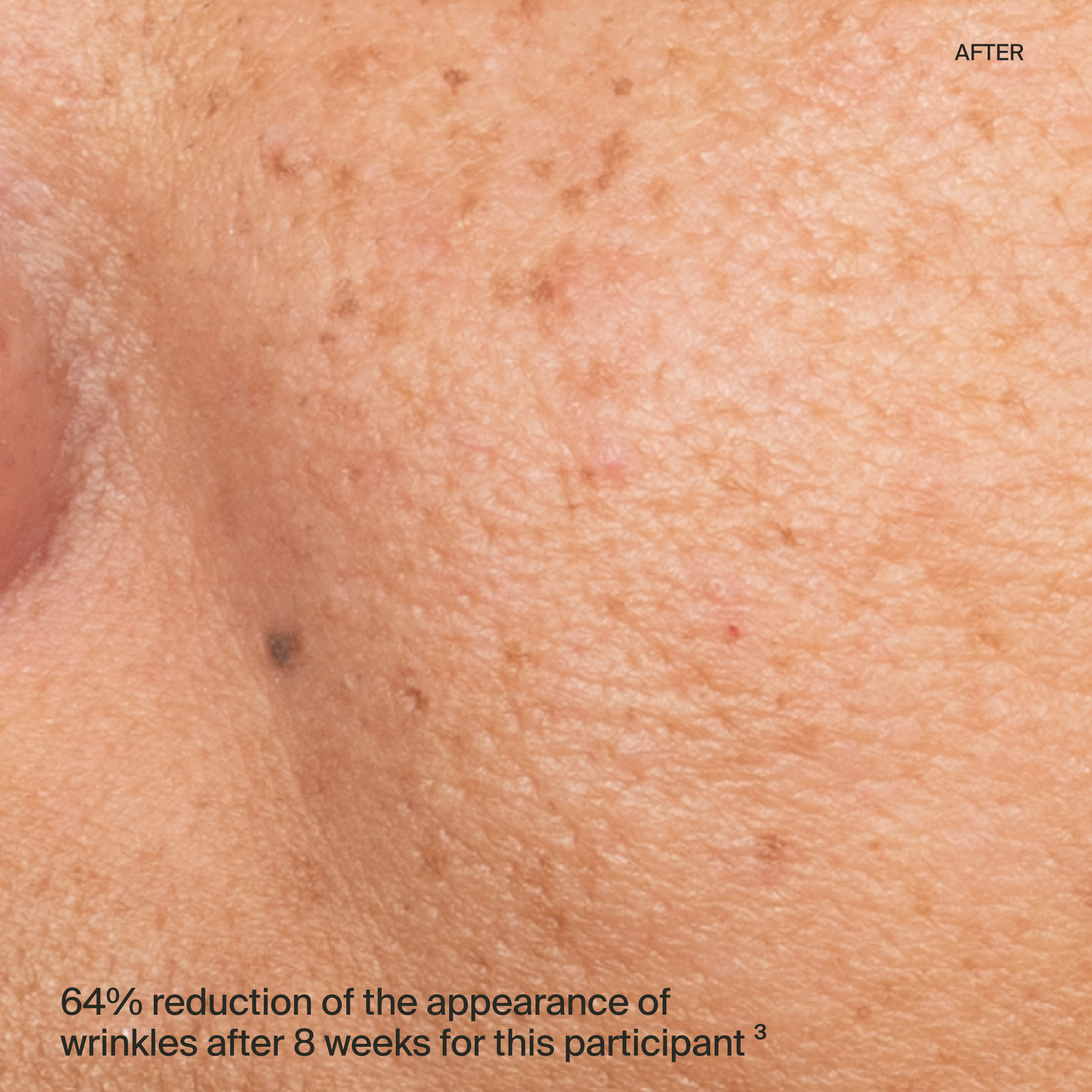 serum after-thumbnail