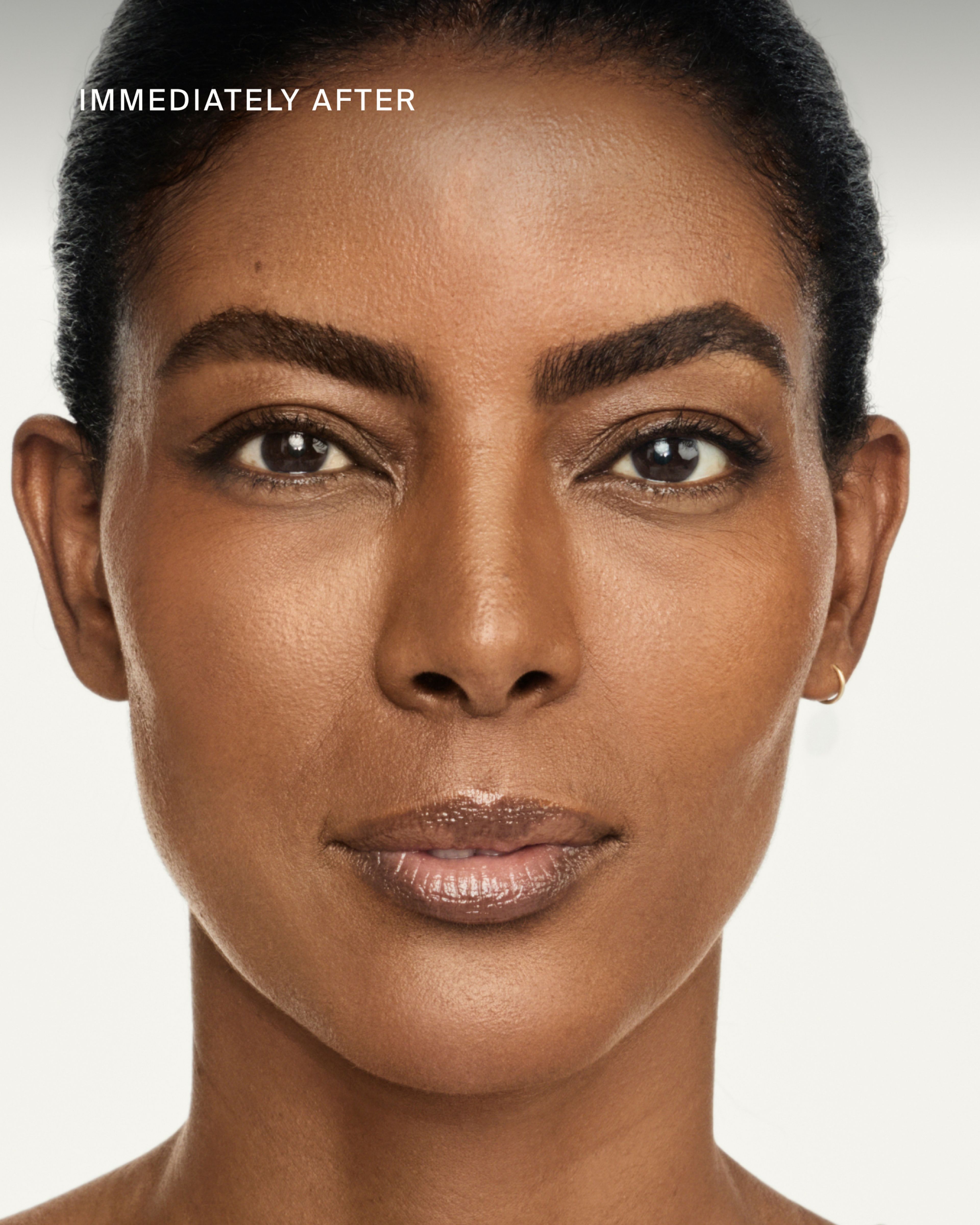 Mito-Biotic™ Firming Serum