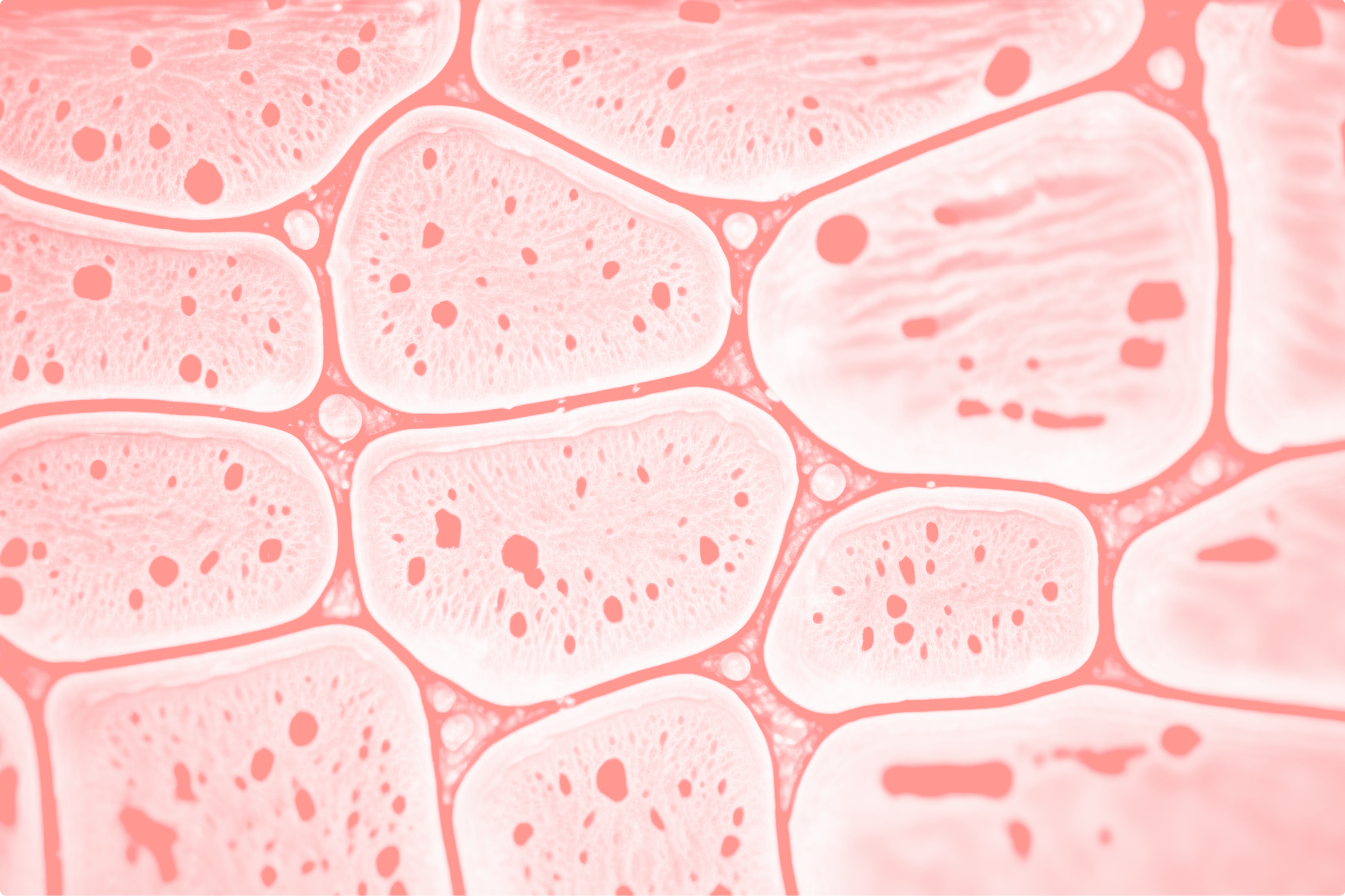 Skin cells