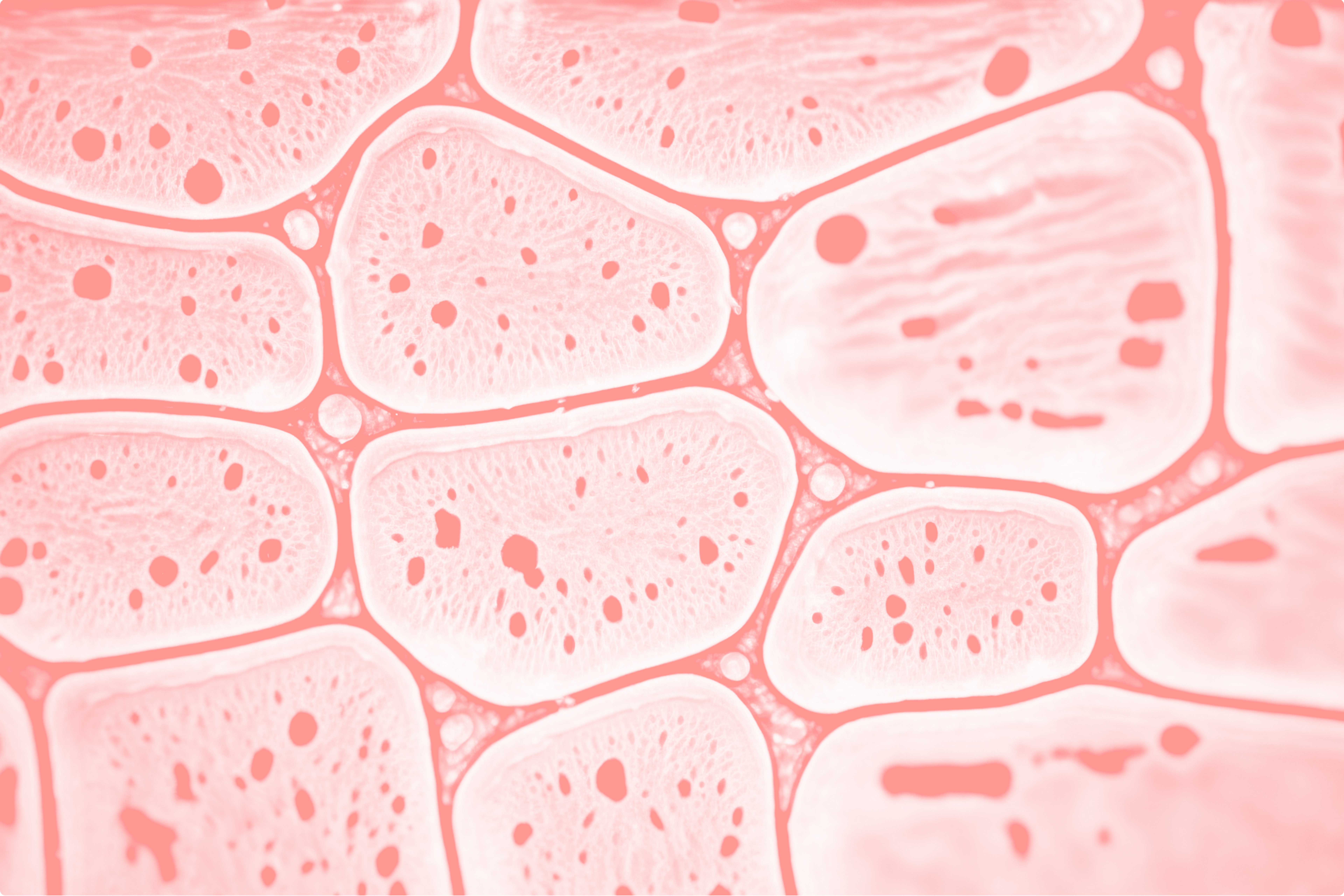 Skin cells