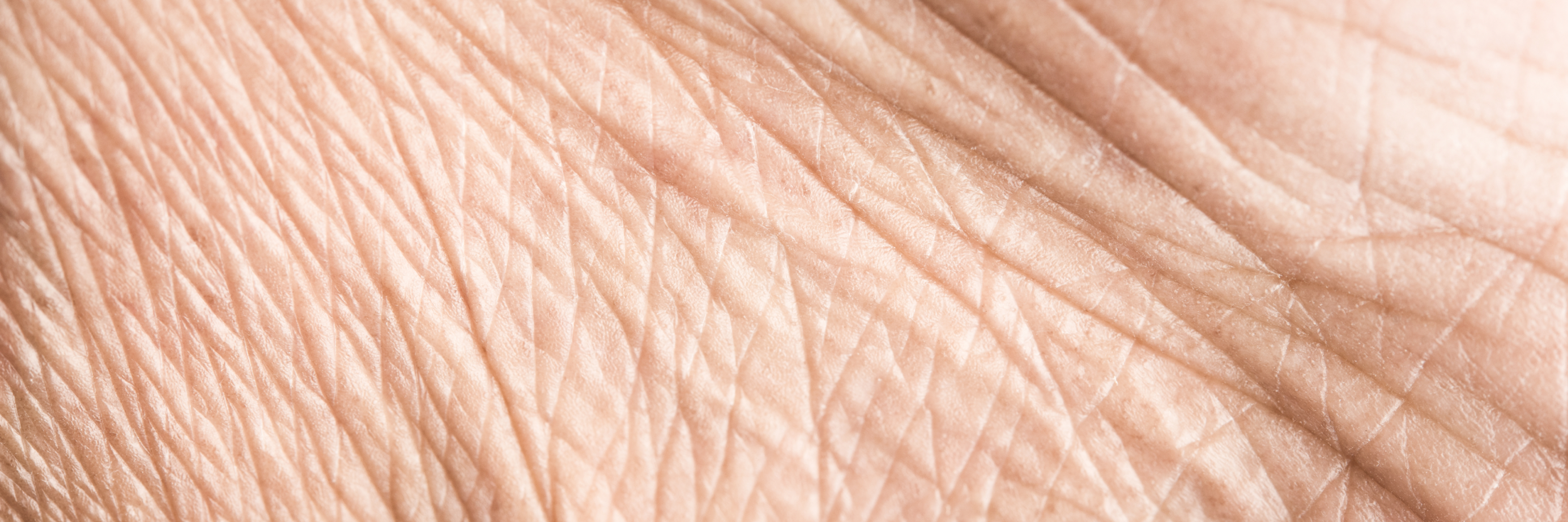 Wrinkled skin