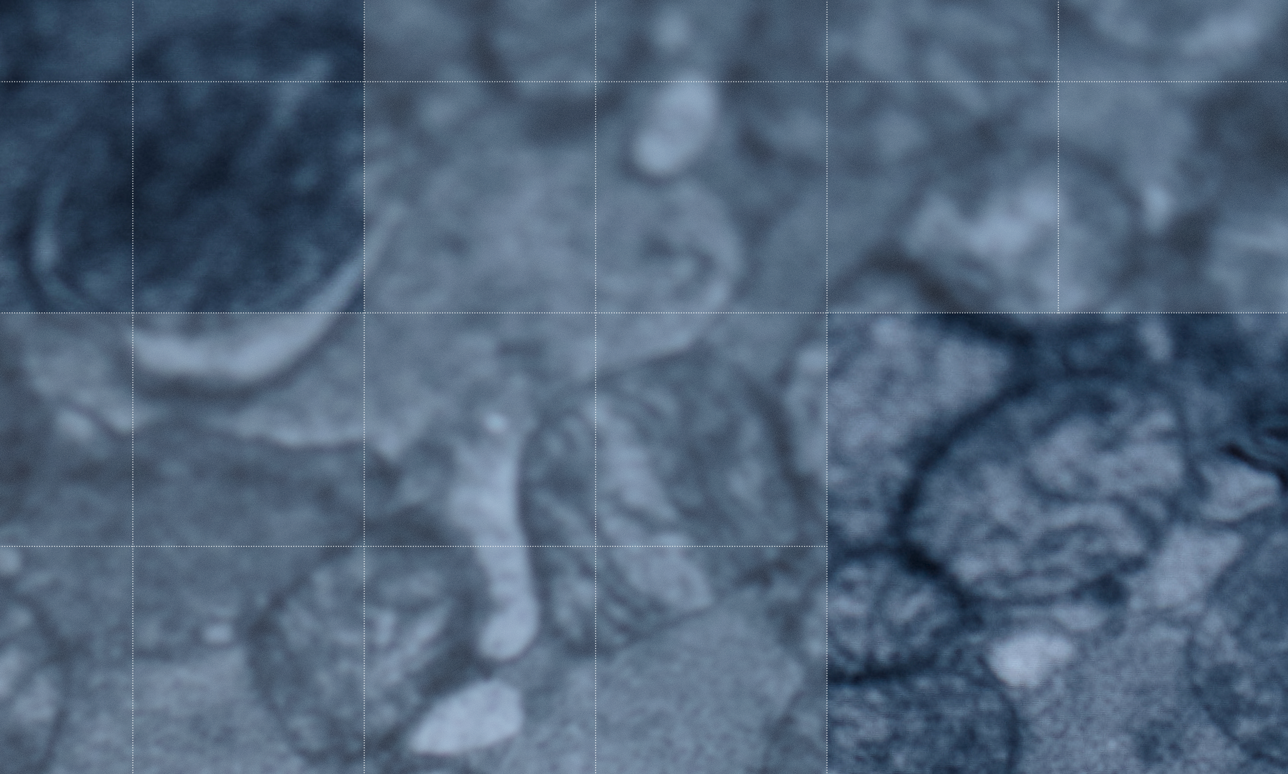 cells