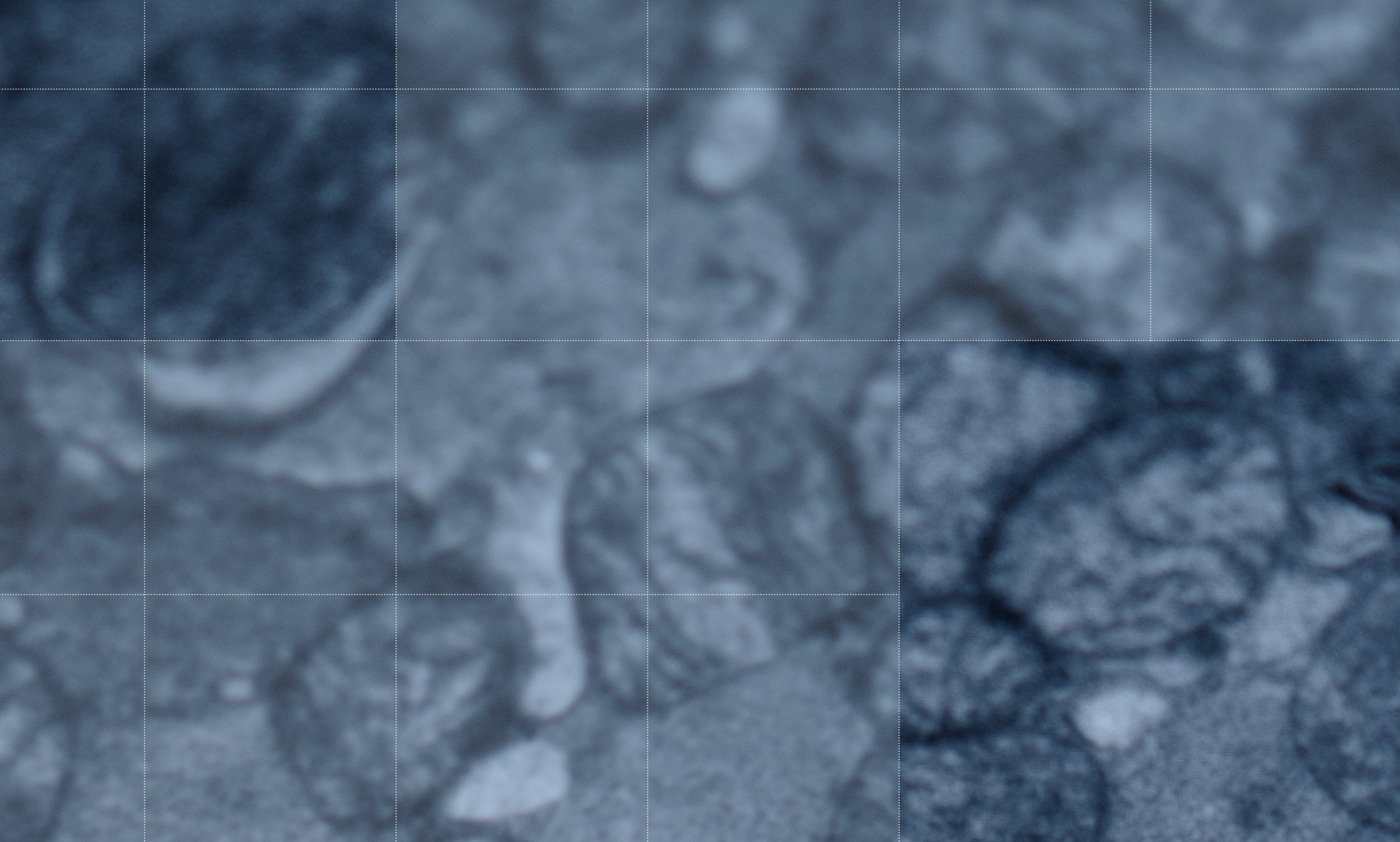 cells