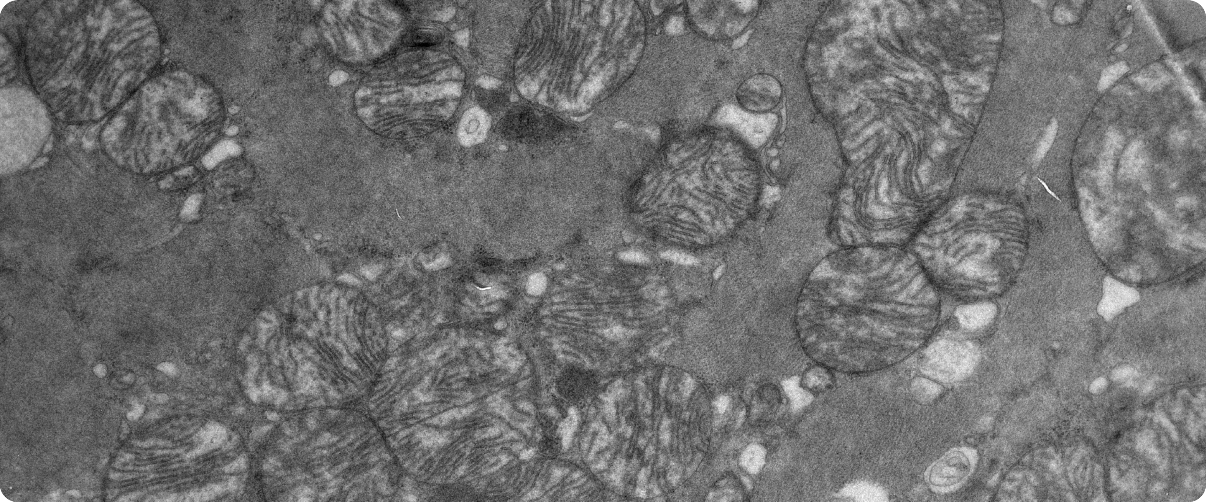 mitochondria