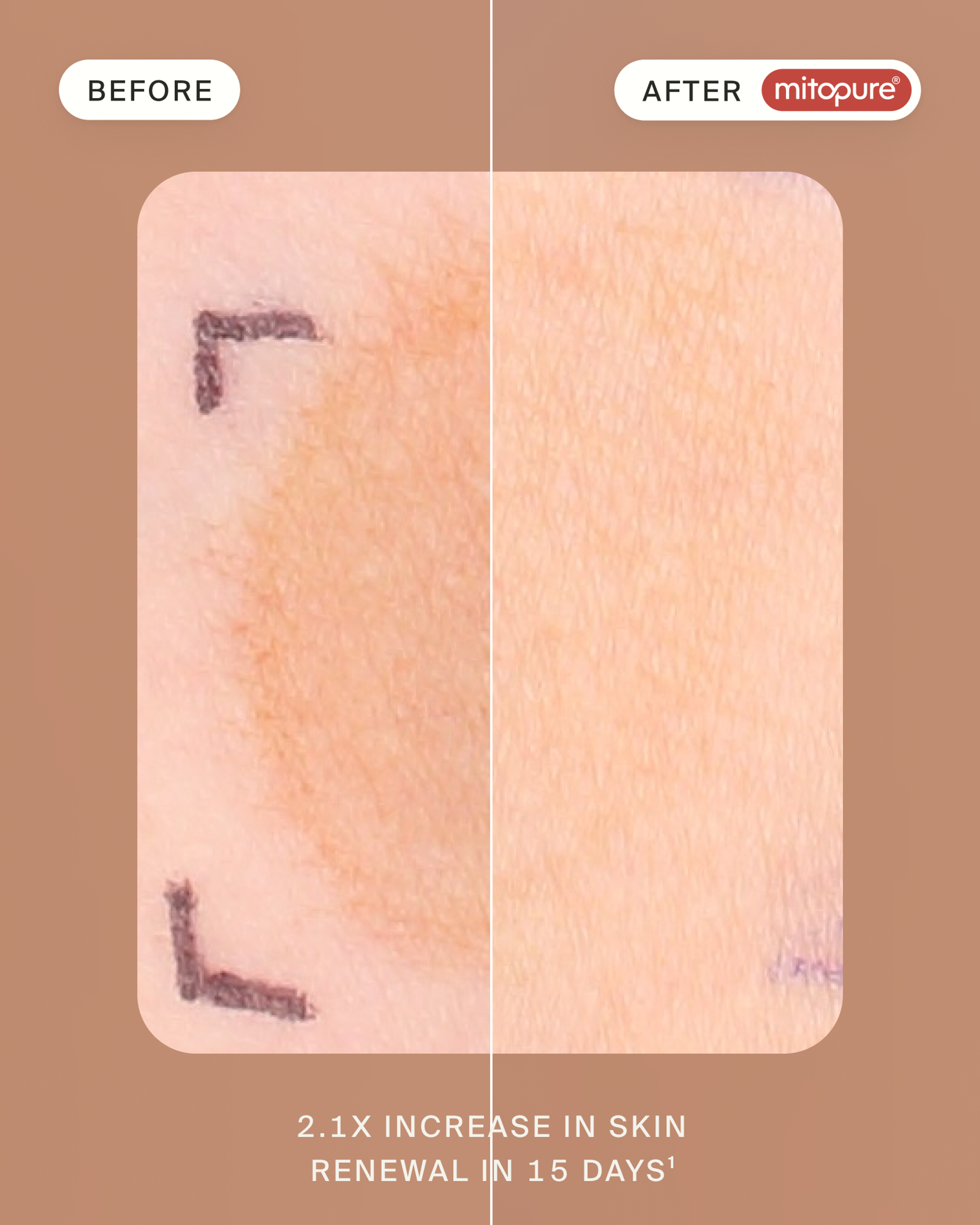 Mitopure Resurfacing Exfoliator