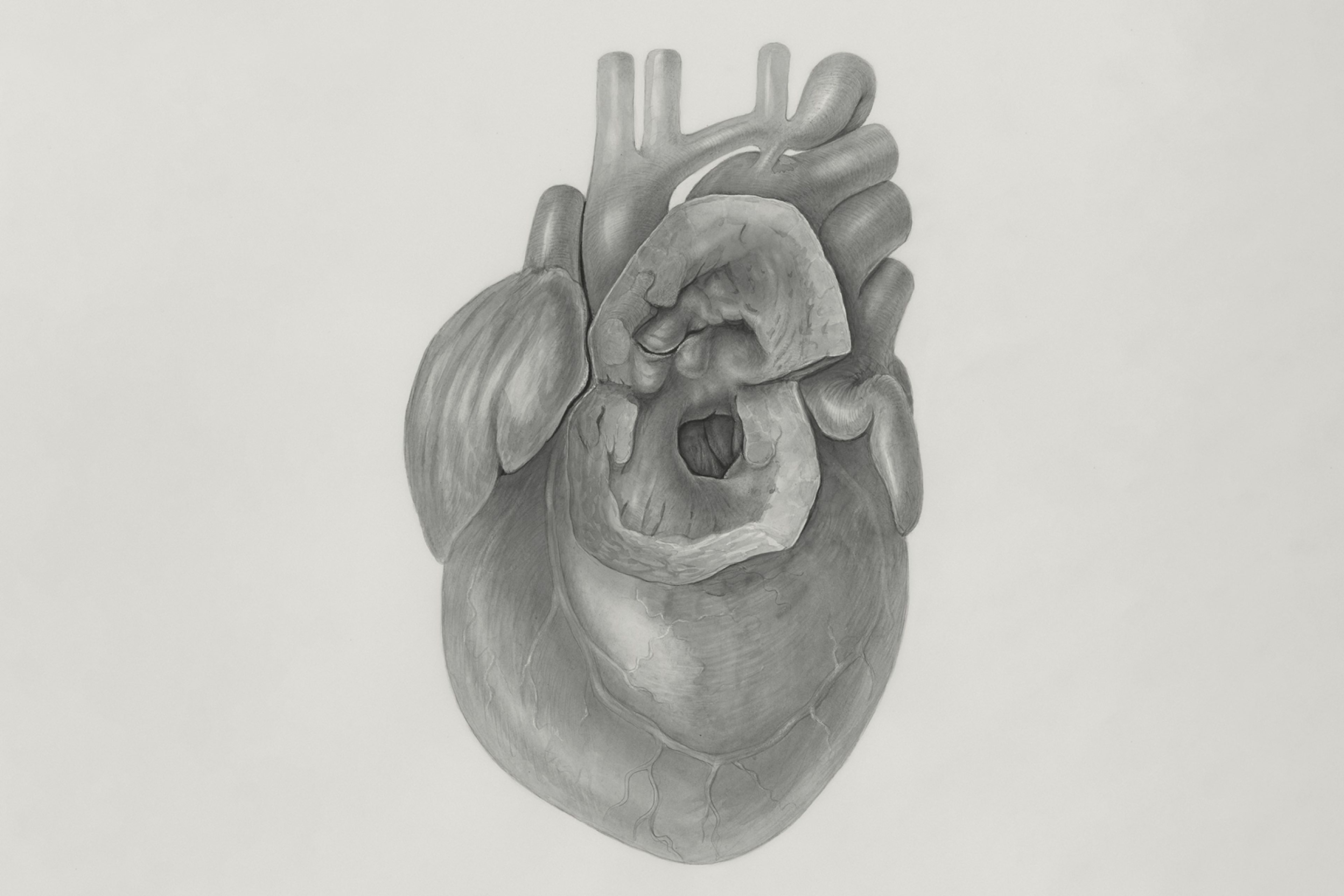 Heart