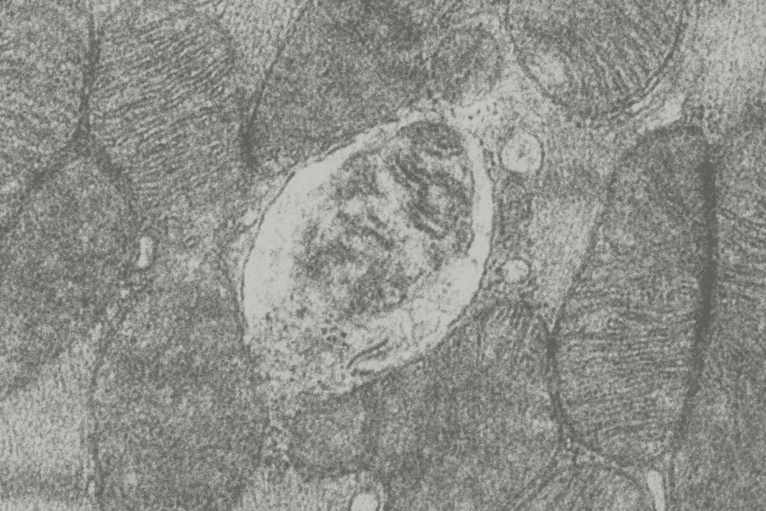 mitochondria