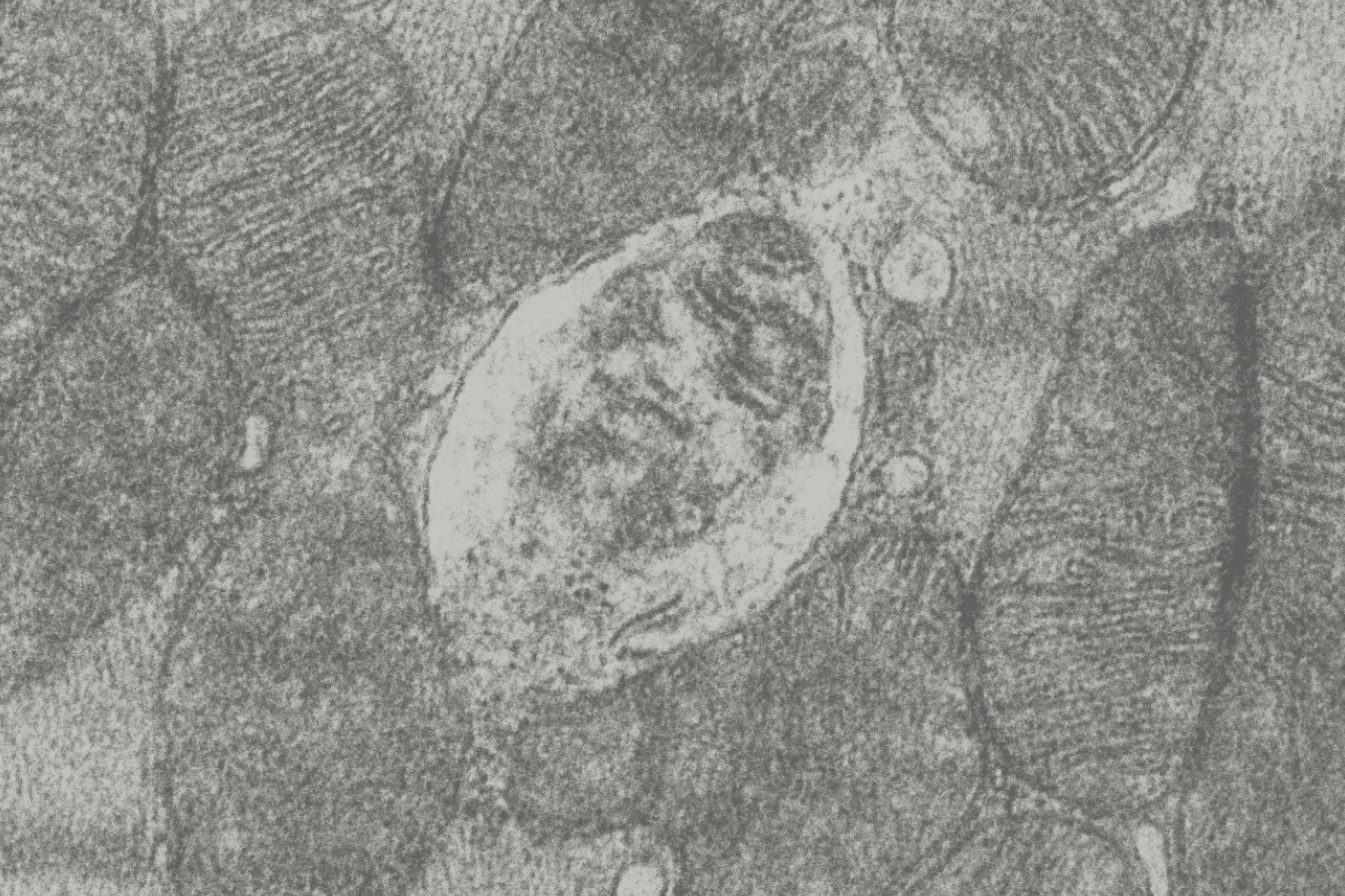 mitochondria