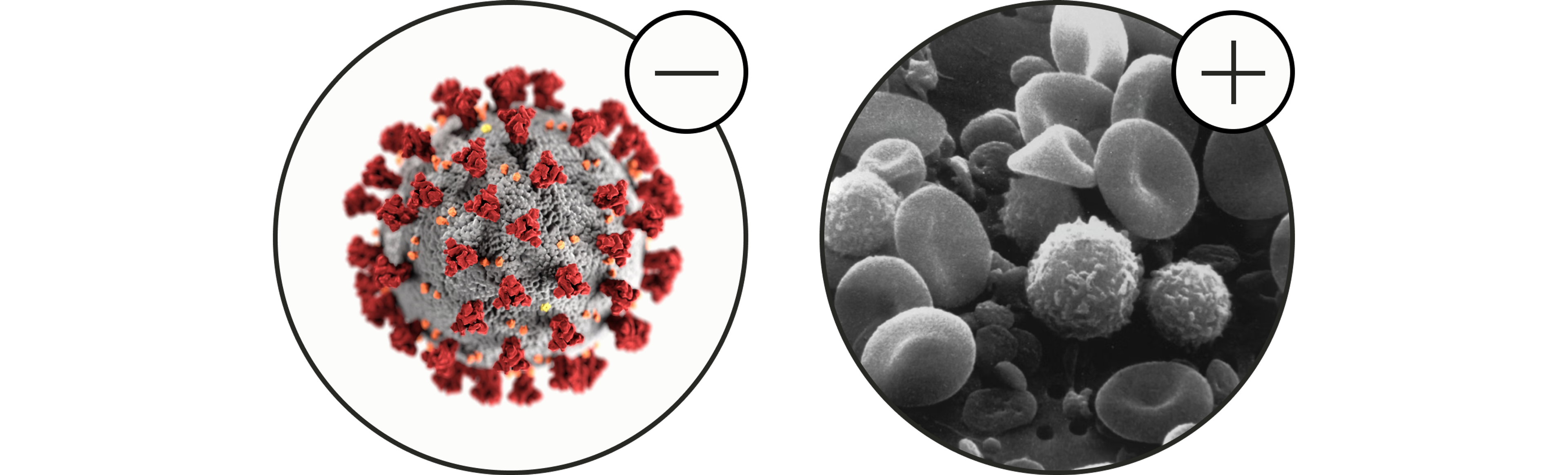 Less pathogens, more immune-active cells