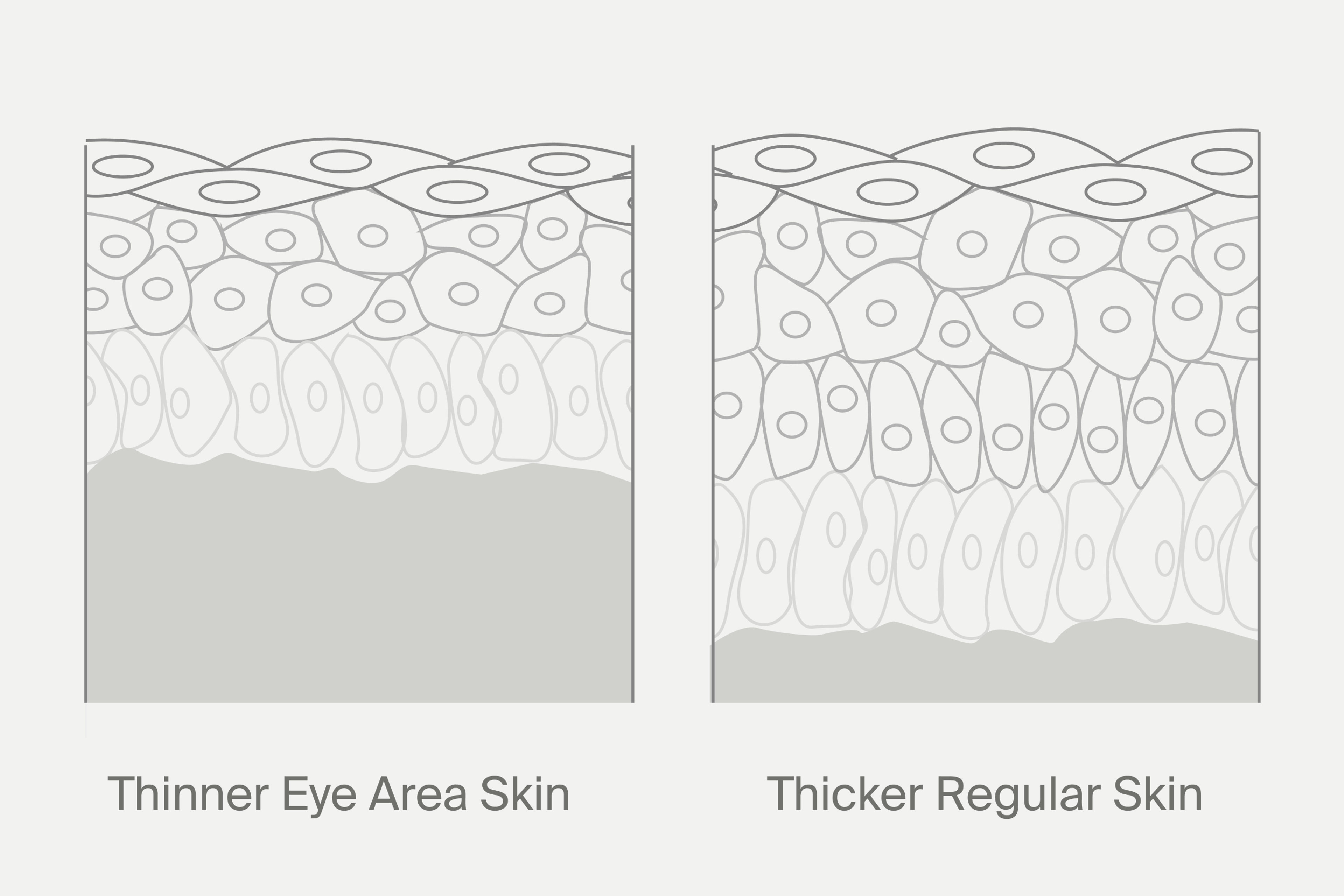 Eye Area skin vs Regular Skin