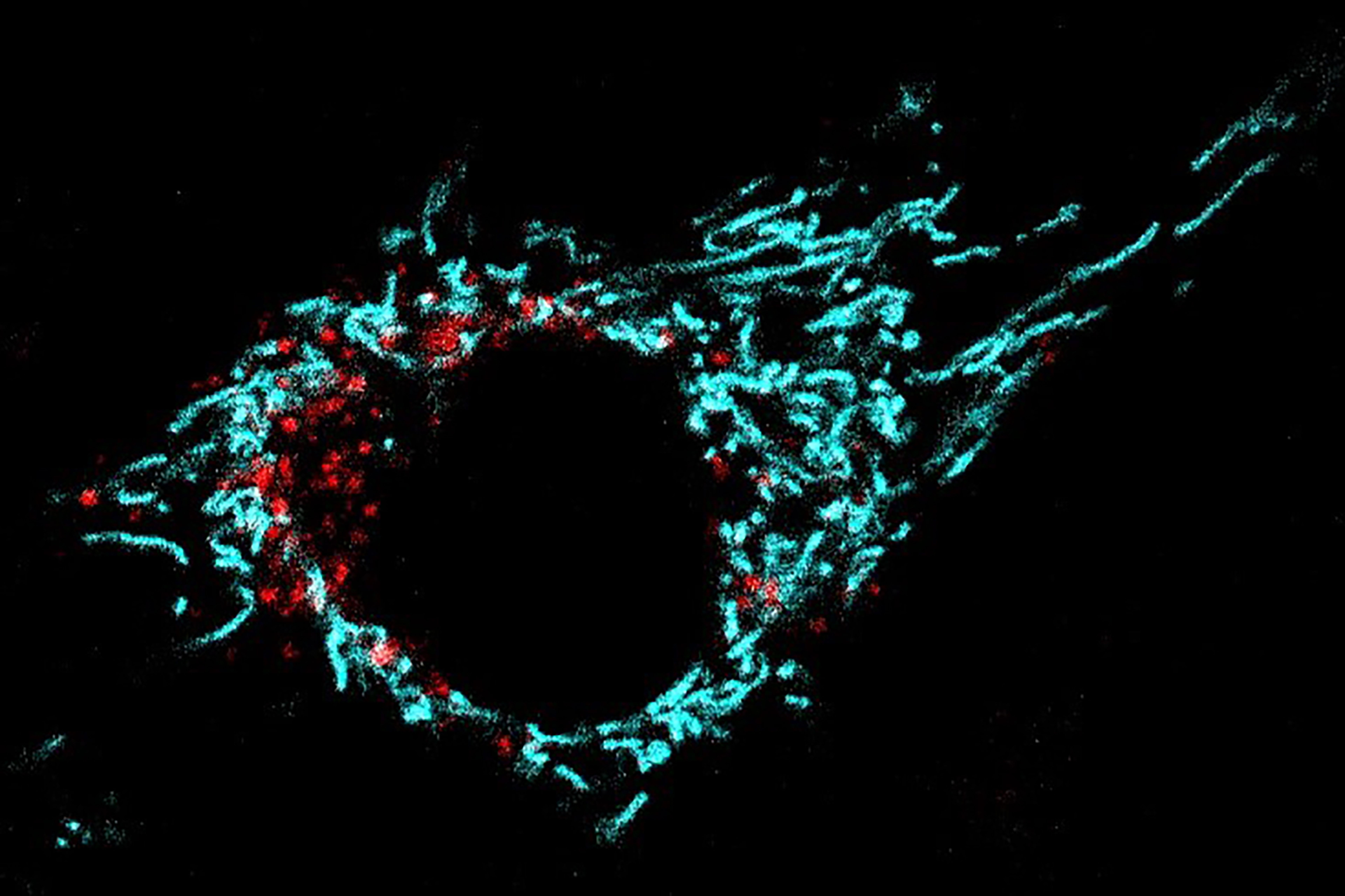 A muscle cell (C2C12 myoblast) stained with the mitochondrial marker mKEIMA. In cyan is represented the normal mitochondrial network. The red dots show mitochondria undergoing mitophagy. (Credit: Davide D’Amico/EPFL)