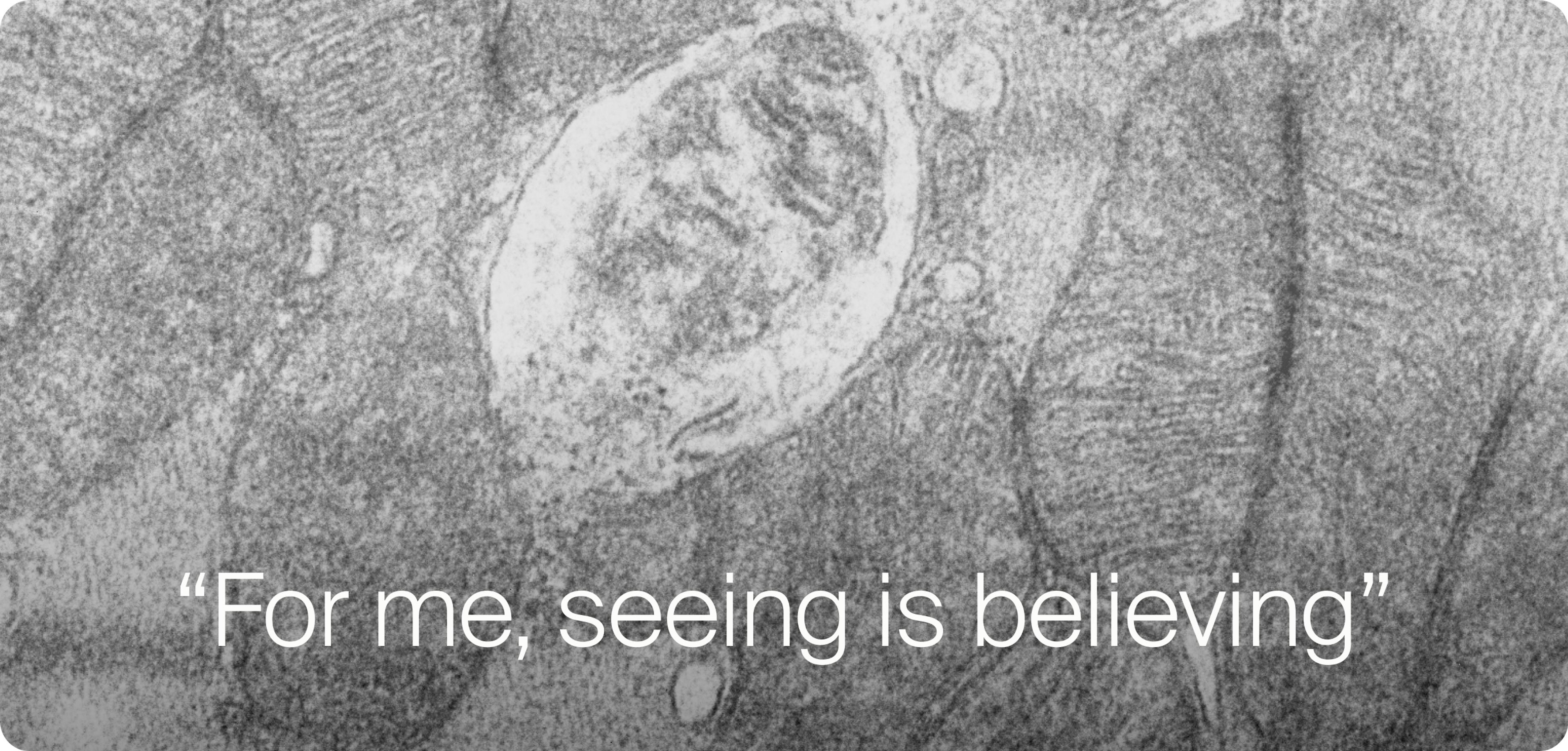 Seeing is believing - Mitochondria image