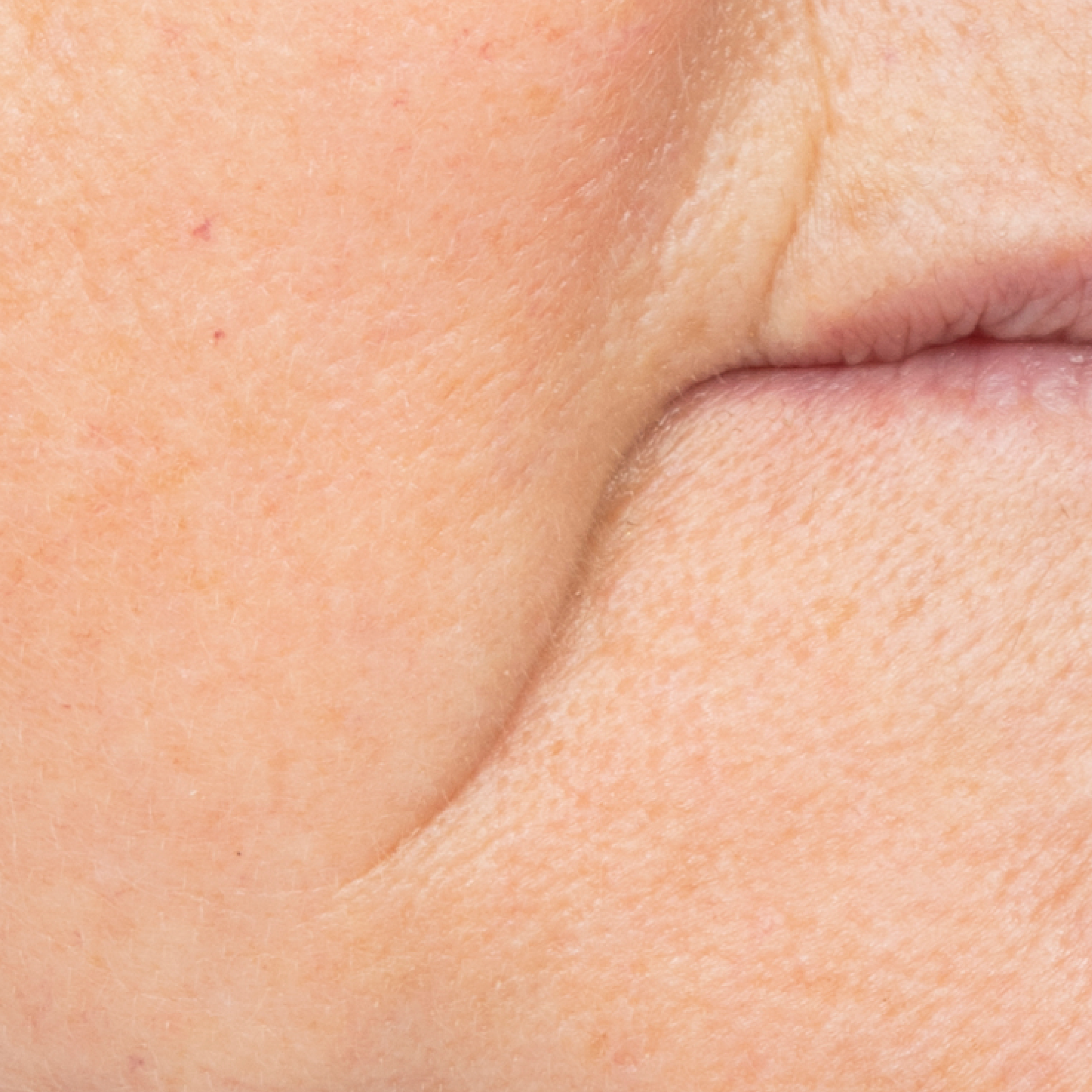 Before Barrier Cream