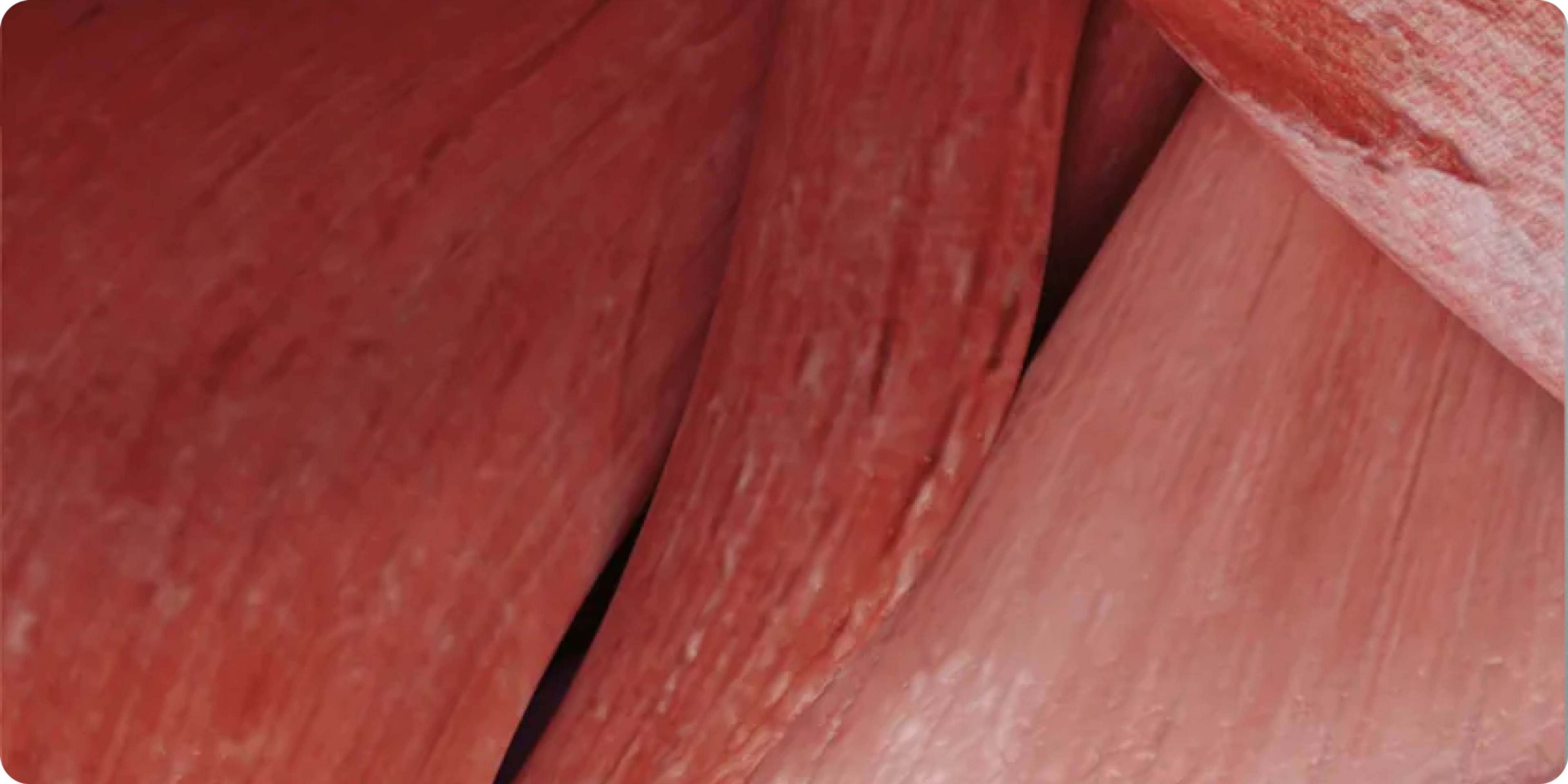 Muscle fibers