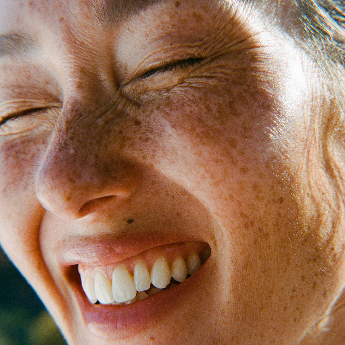 Mitopure (Urolithin A) Benefits