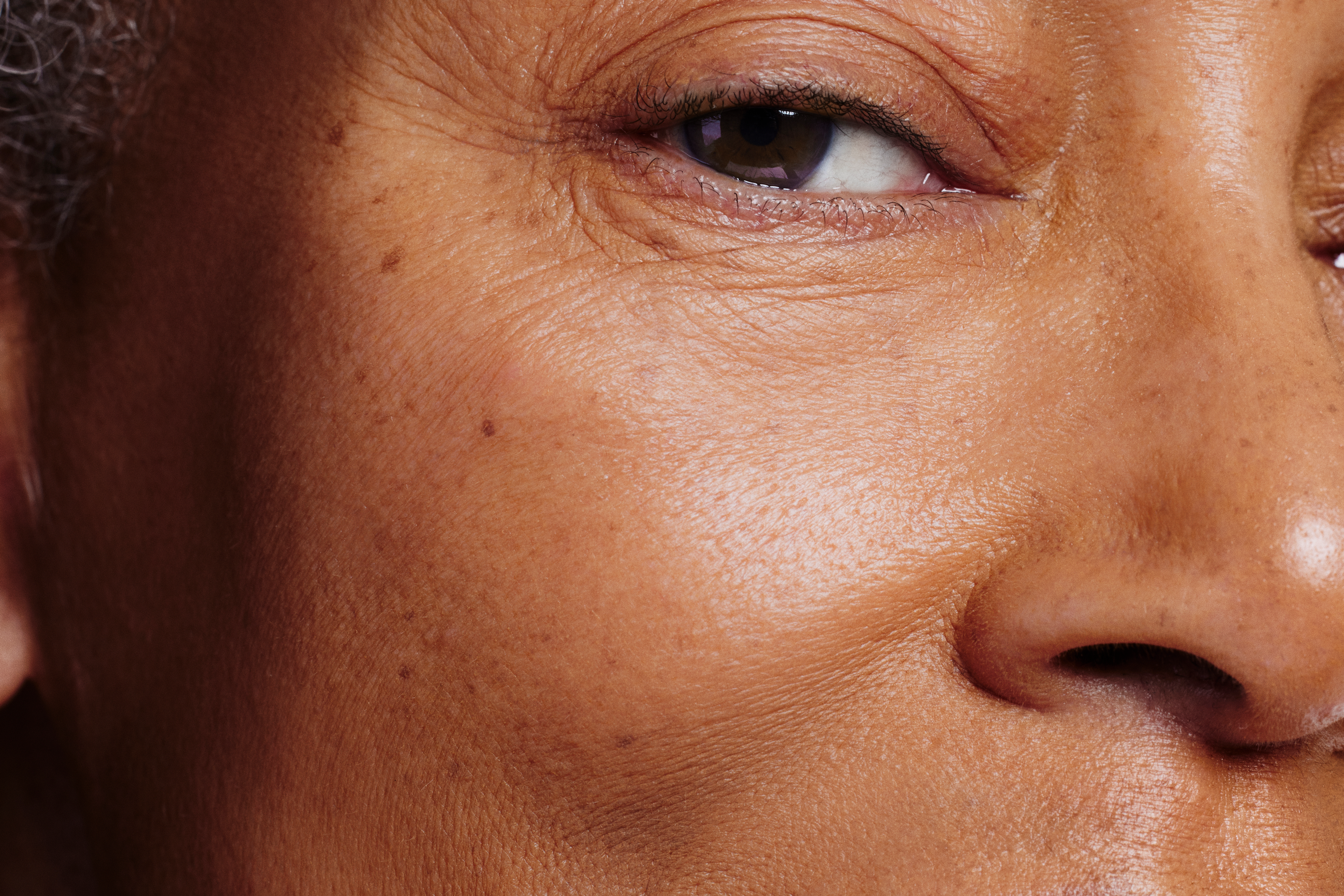Skin Close Up