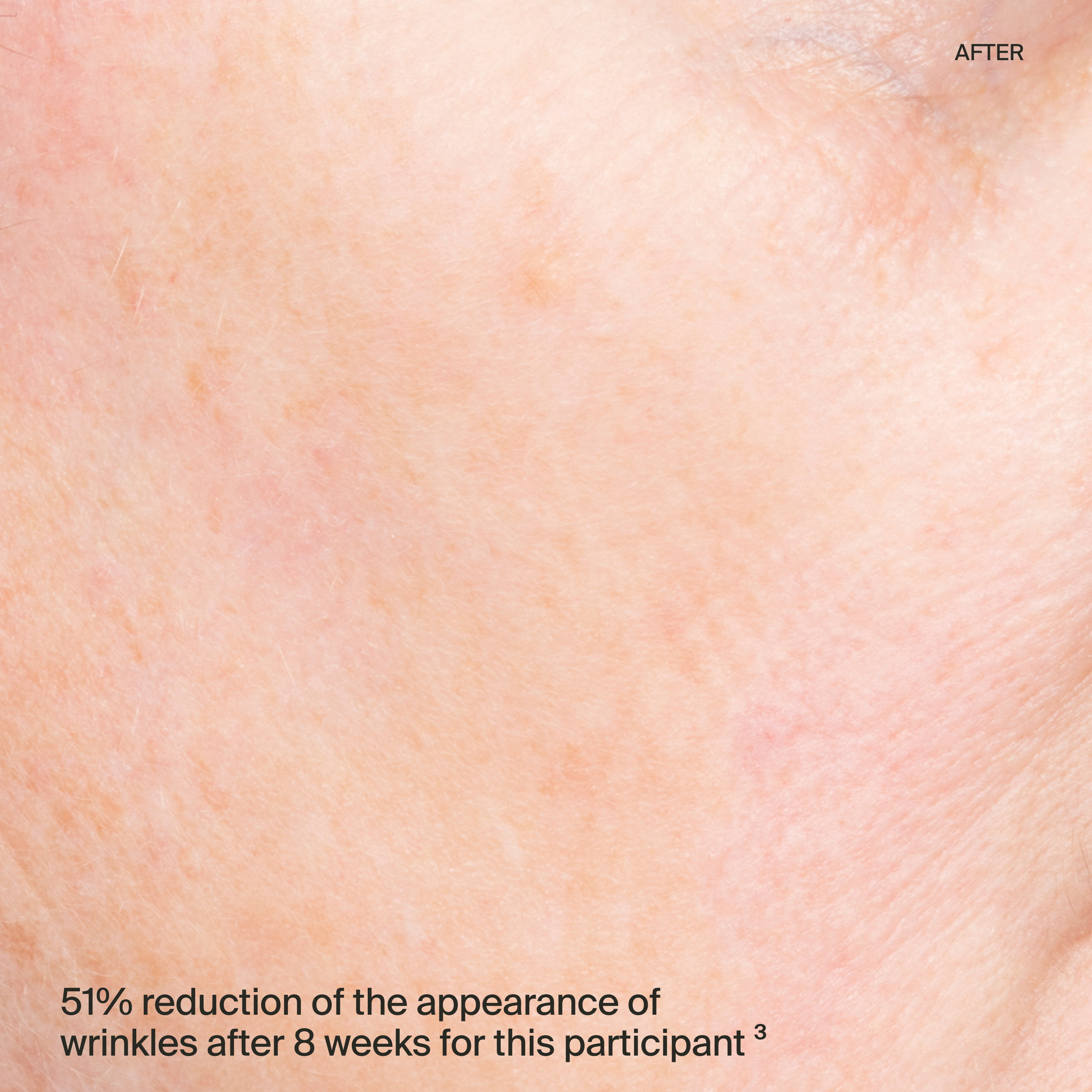  serum cheek after-thumbnail