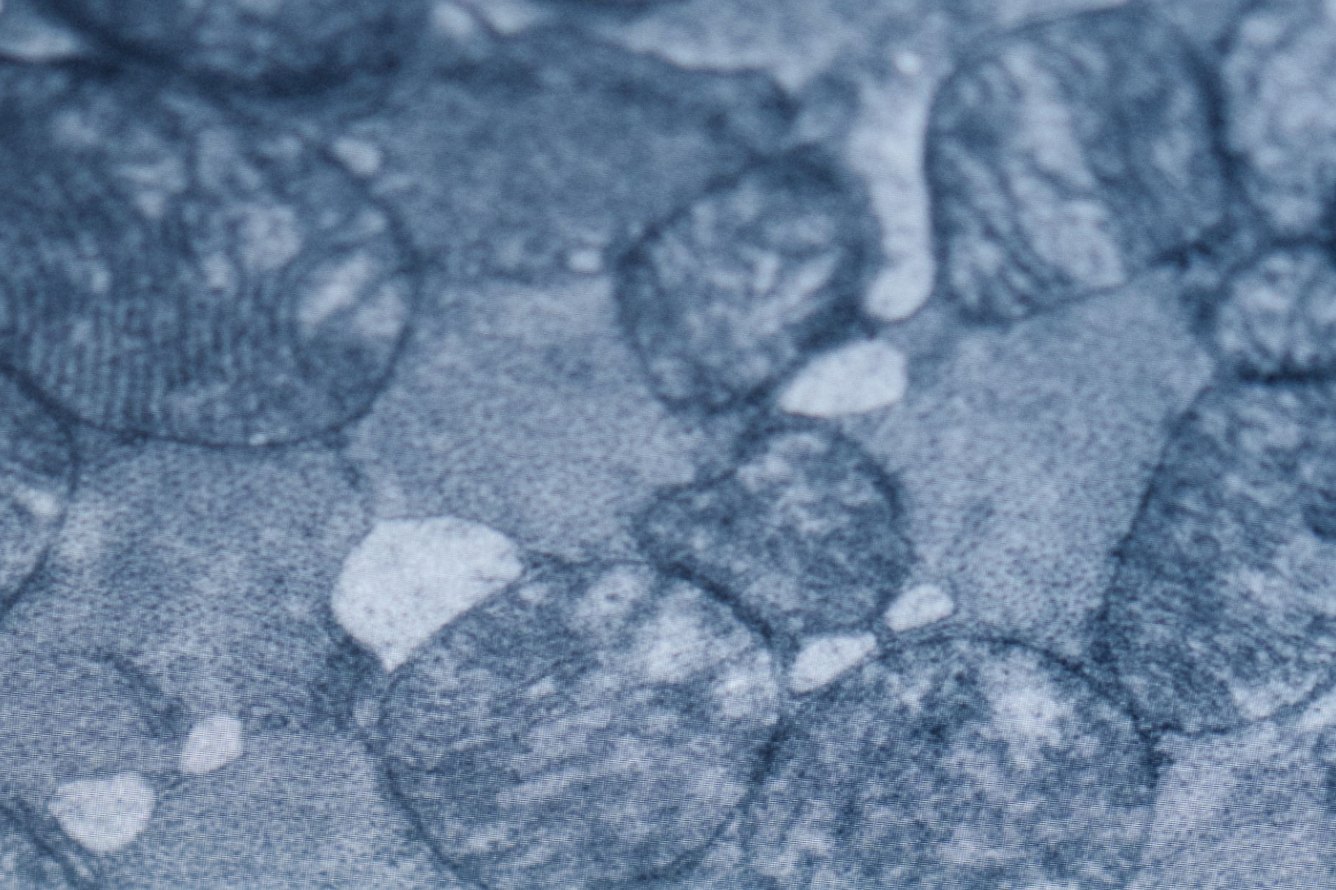 microscopic image of mitochondria