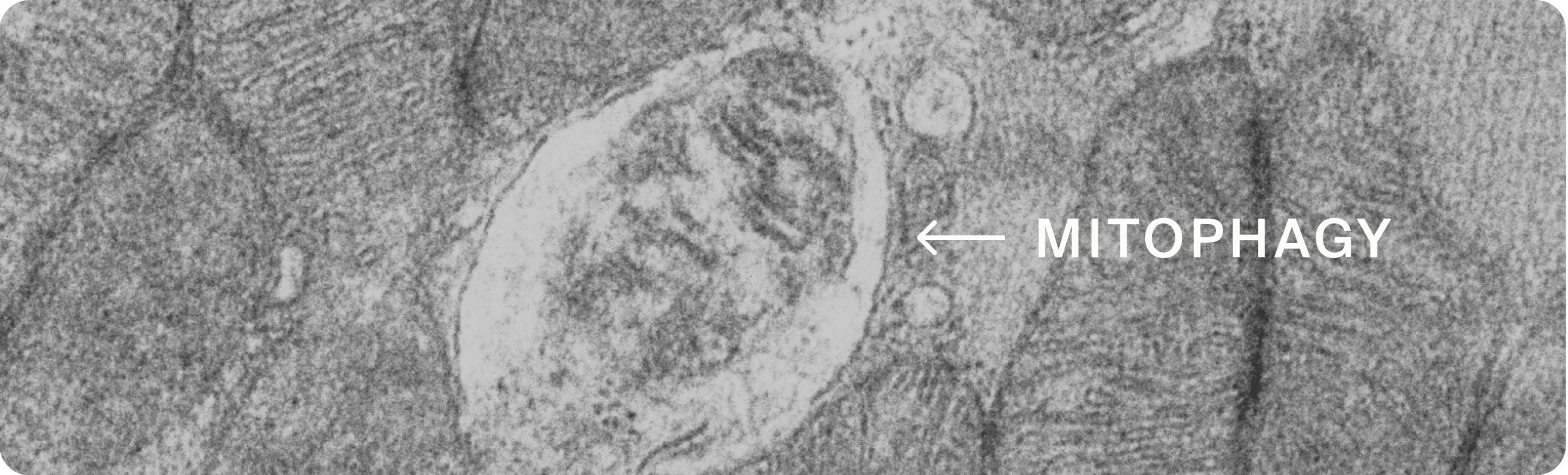 MITOPHAGY