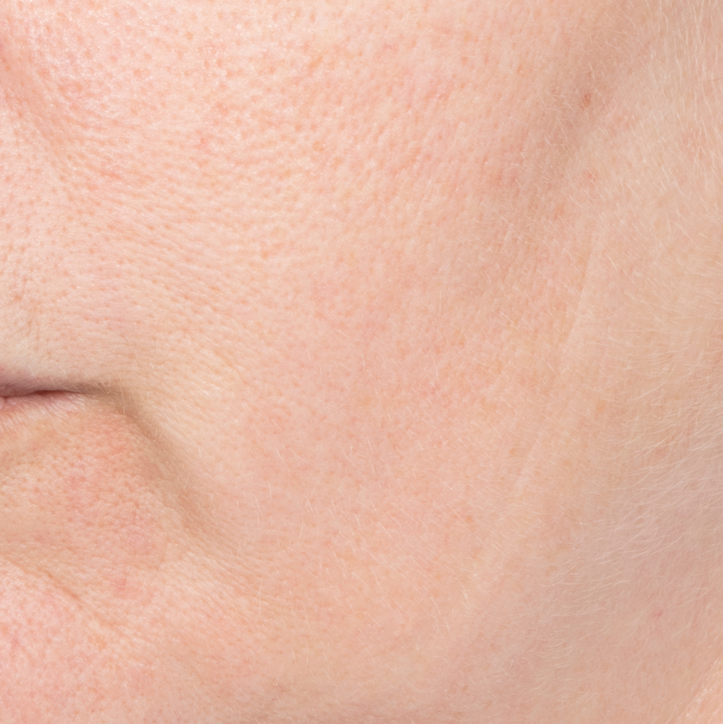 Before Dewy Cream-thumbnail