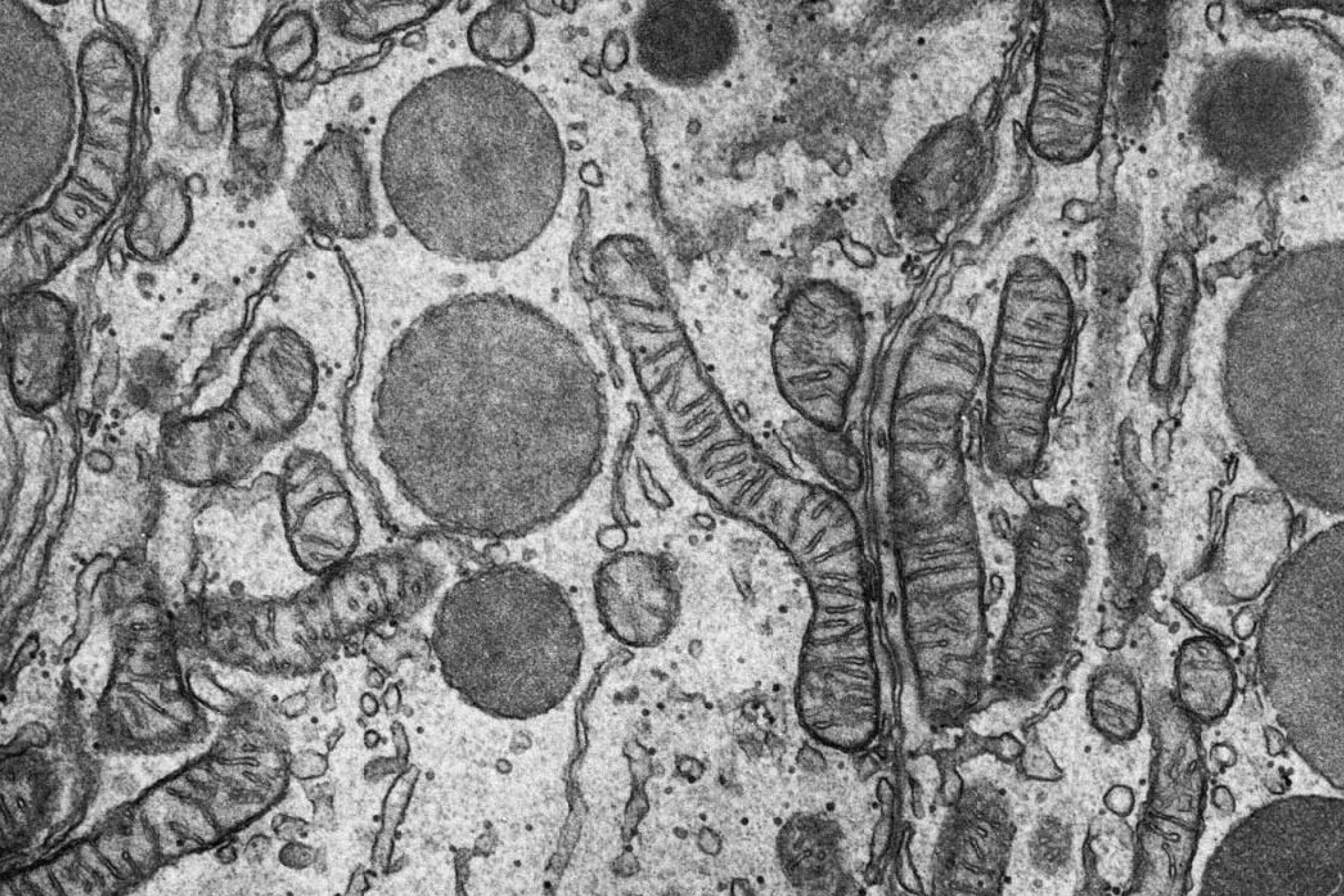 Empty plate and autophagy