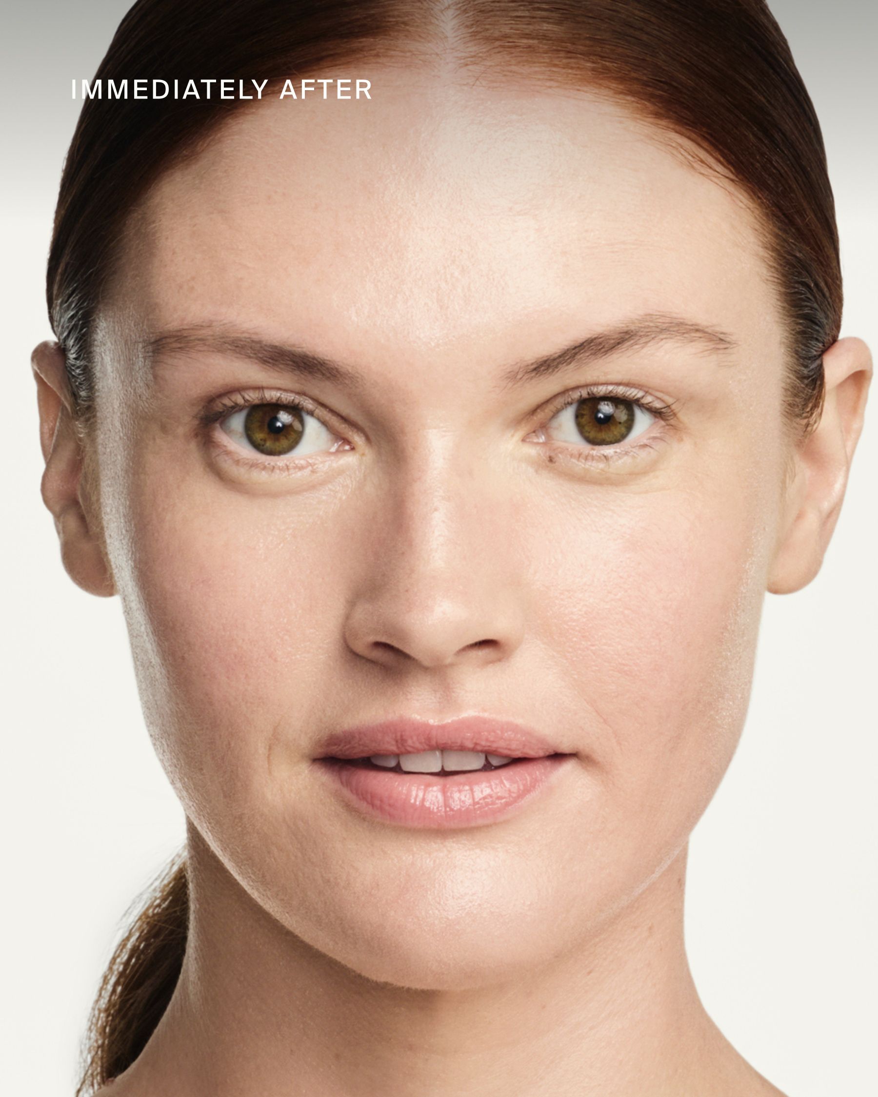 Mito-Biotic™ Dewy Cream