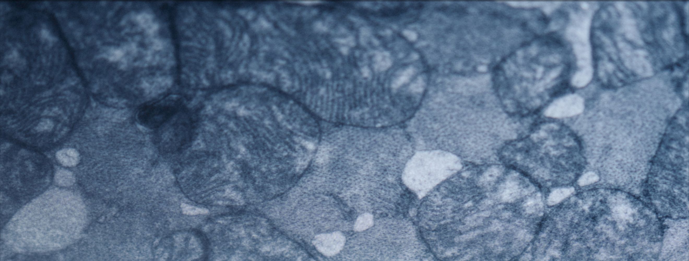 mitochondria for longevity