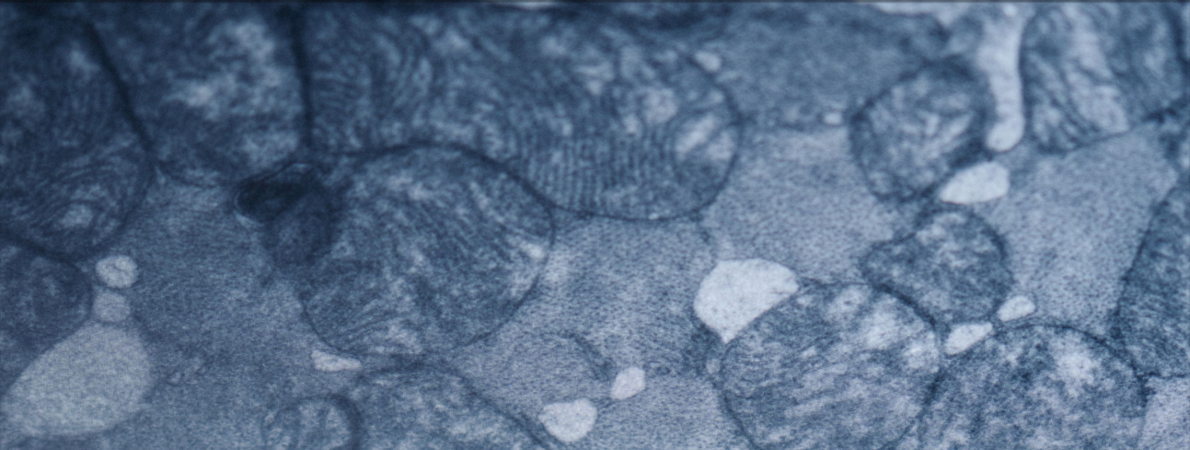 mitochondria for longevity