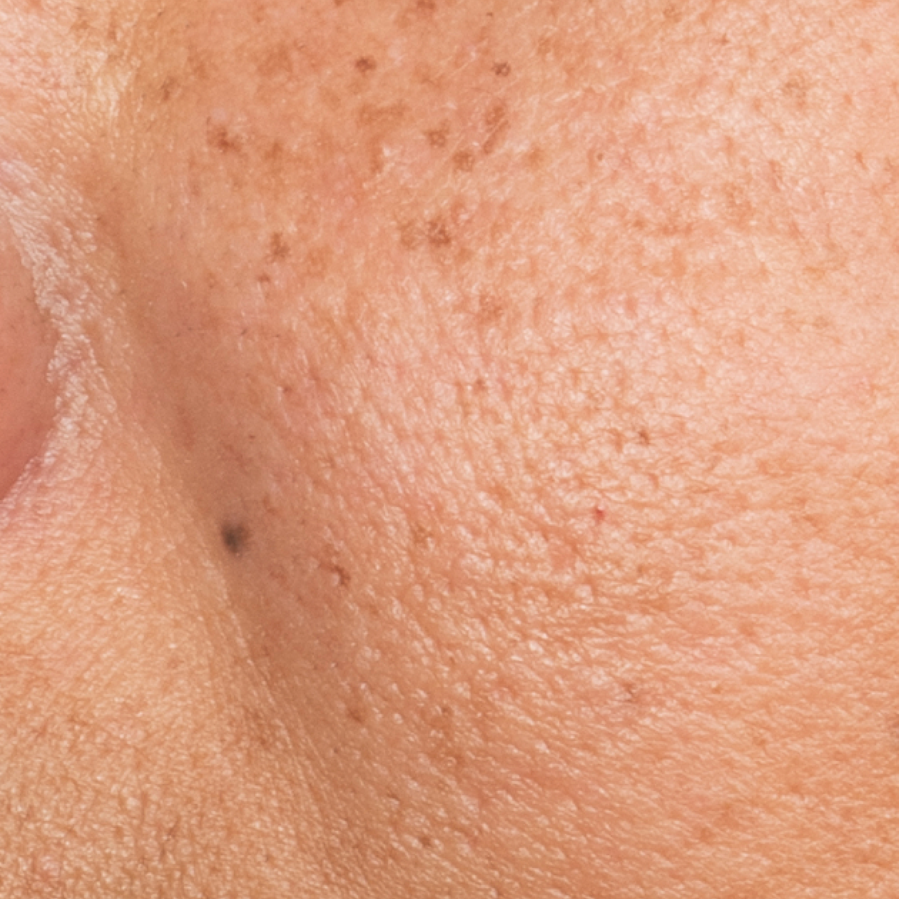 Serum Before-thumbnail