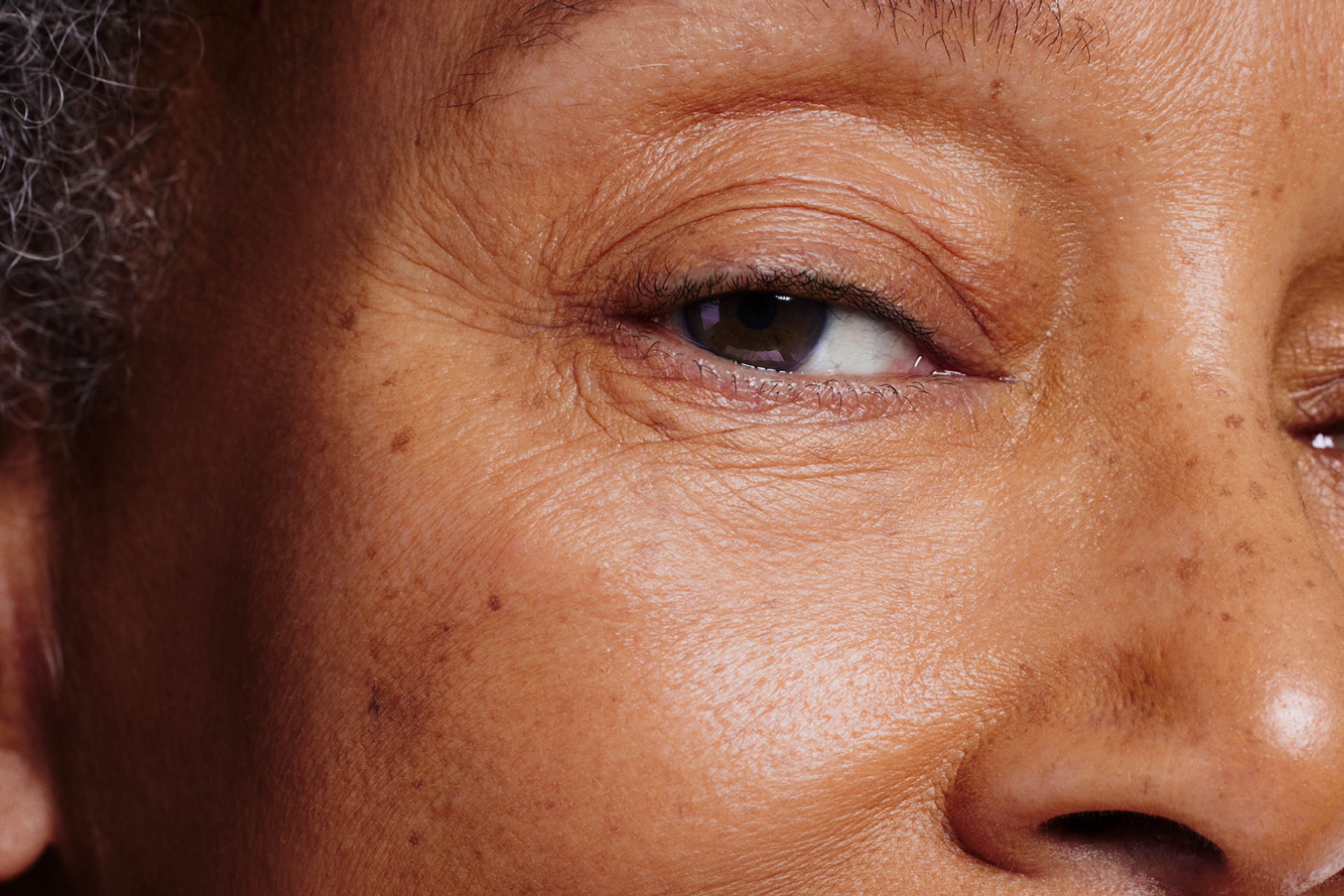 Closeup of a person's face skin