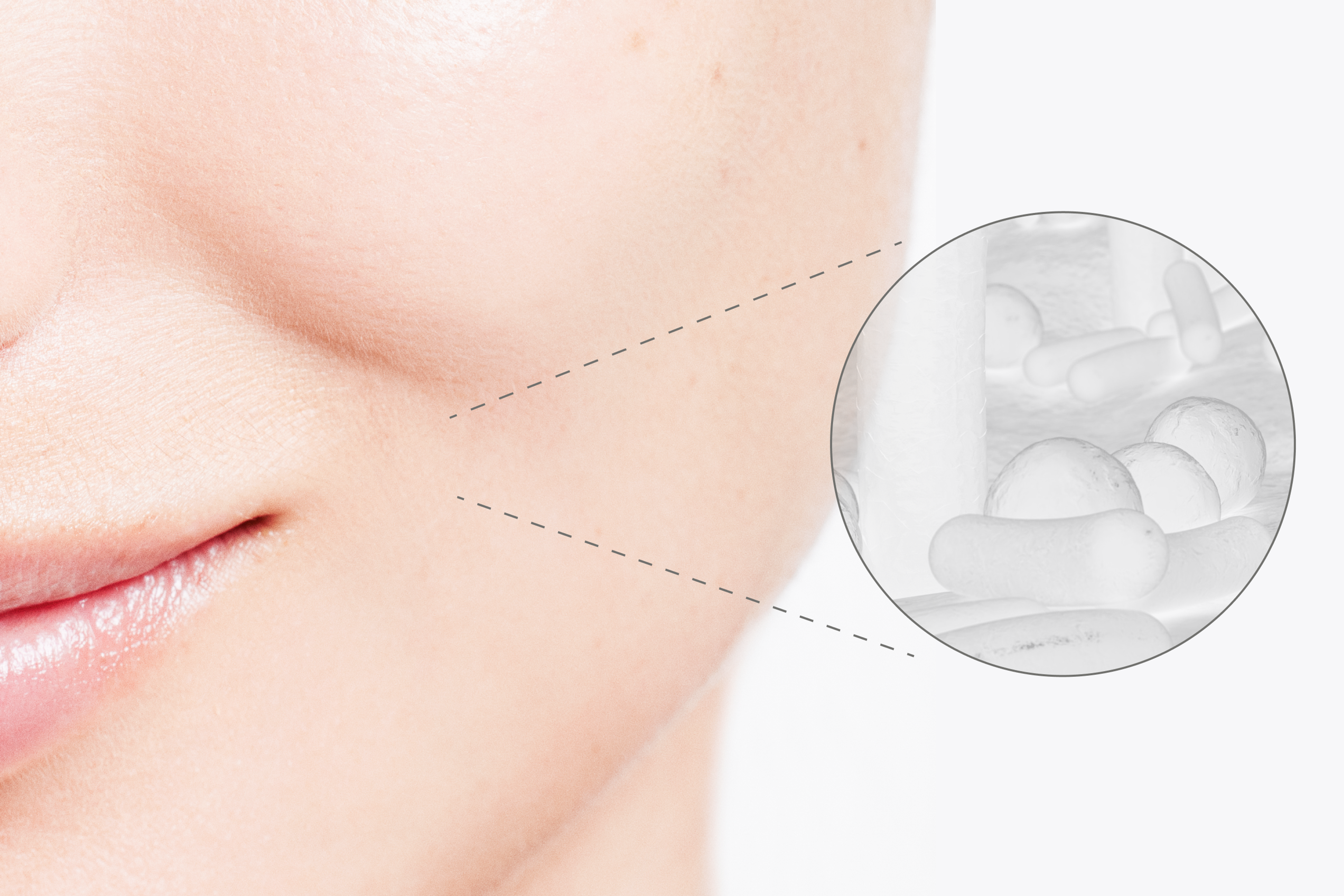 Representation of the Skin Microbiome