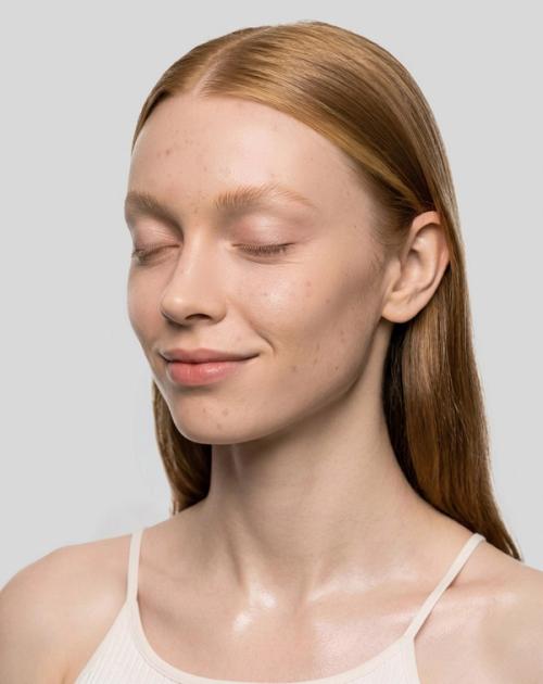 Anti-acne cream on-model skincare photography with natural skin texture — GoPackshot